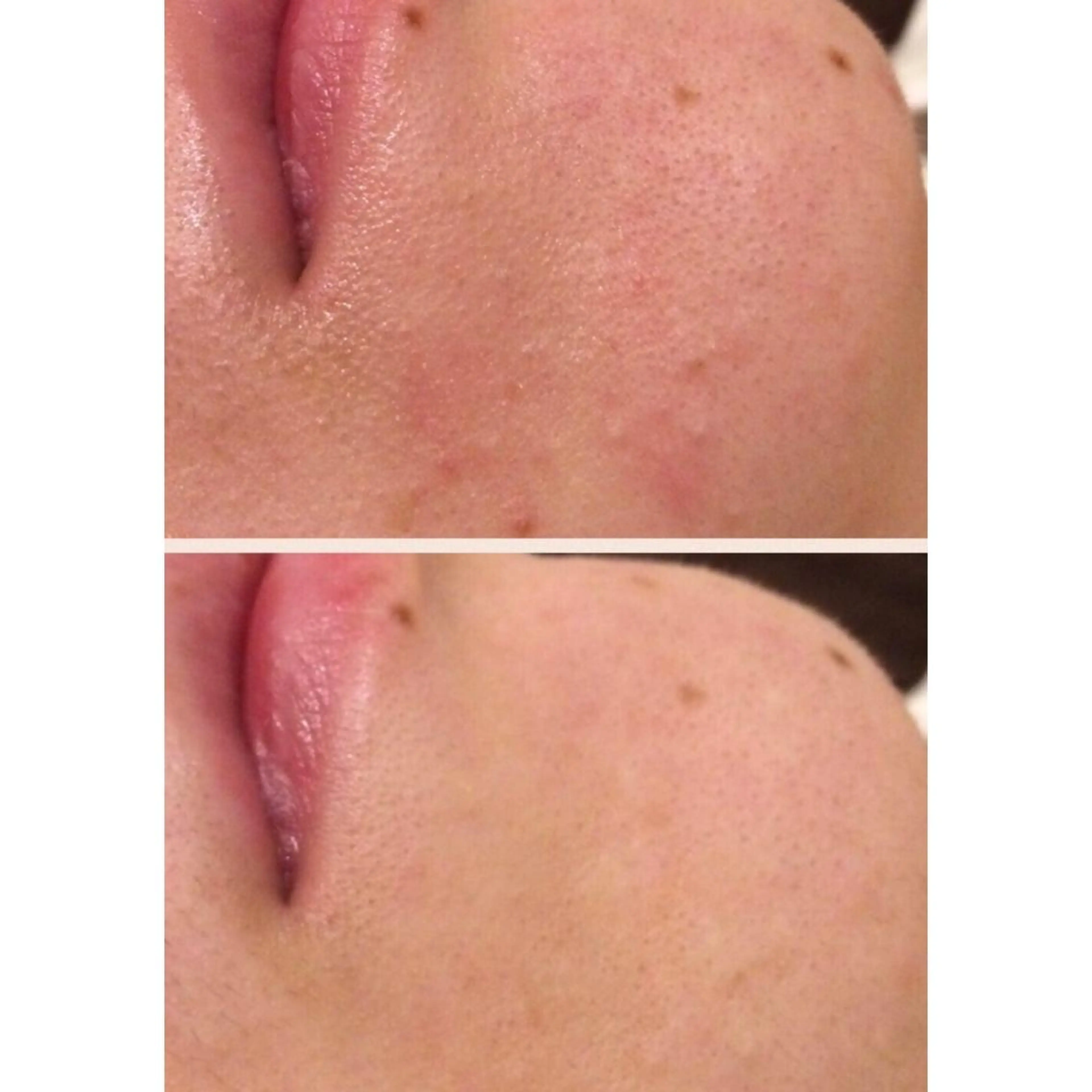 セミロング パーマ ヘアアレンジ メンズ ネイル マツエク・マツパ 金の糸脱毛 産毛ケア専門のエステ・リラクイメージ