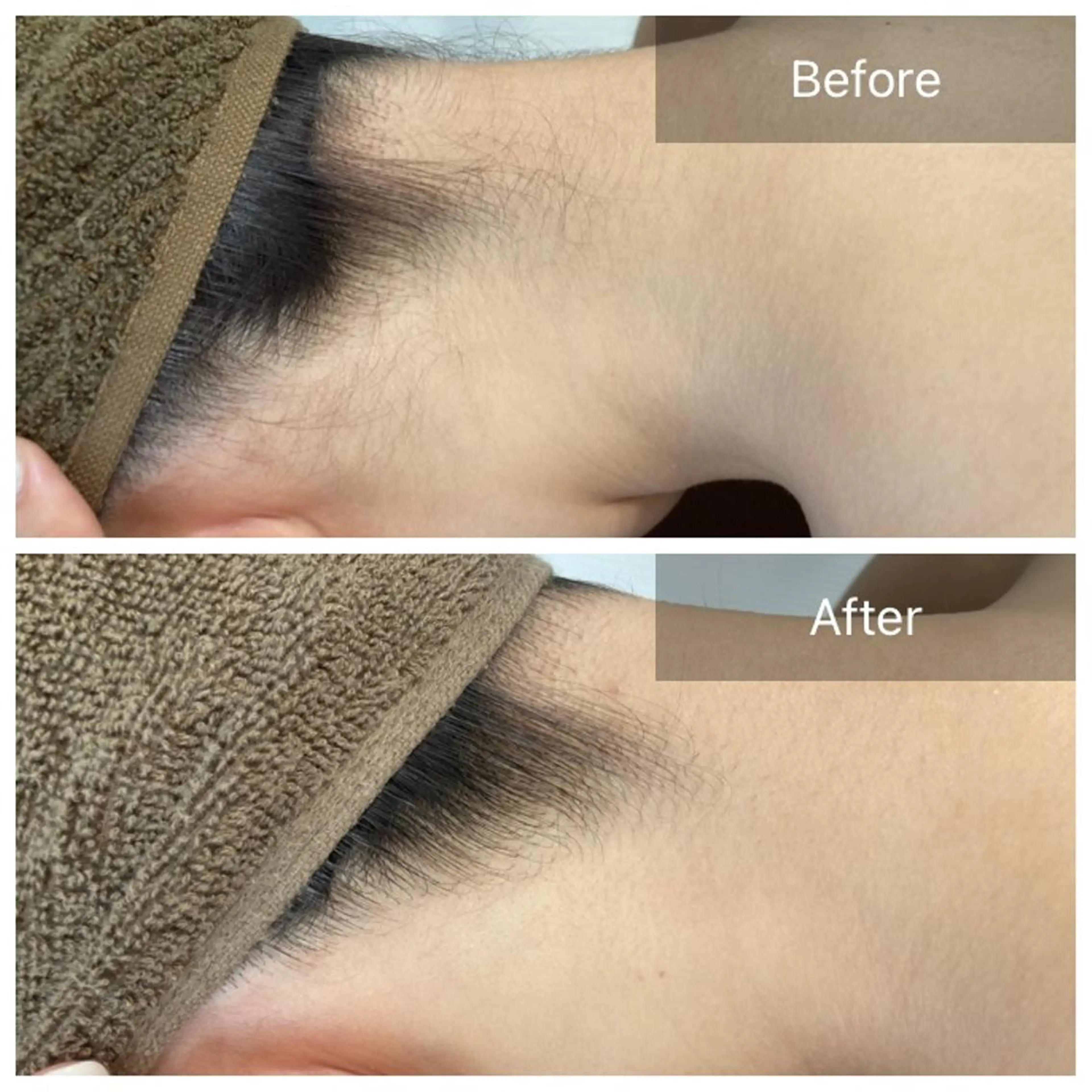 ヘアアレンジ 脱毛 結果重視の脱毛サロン 🦋CLEVY🦋のエステ・リラクイメージ