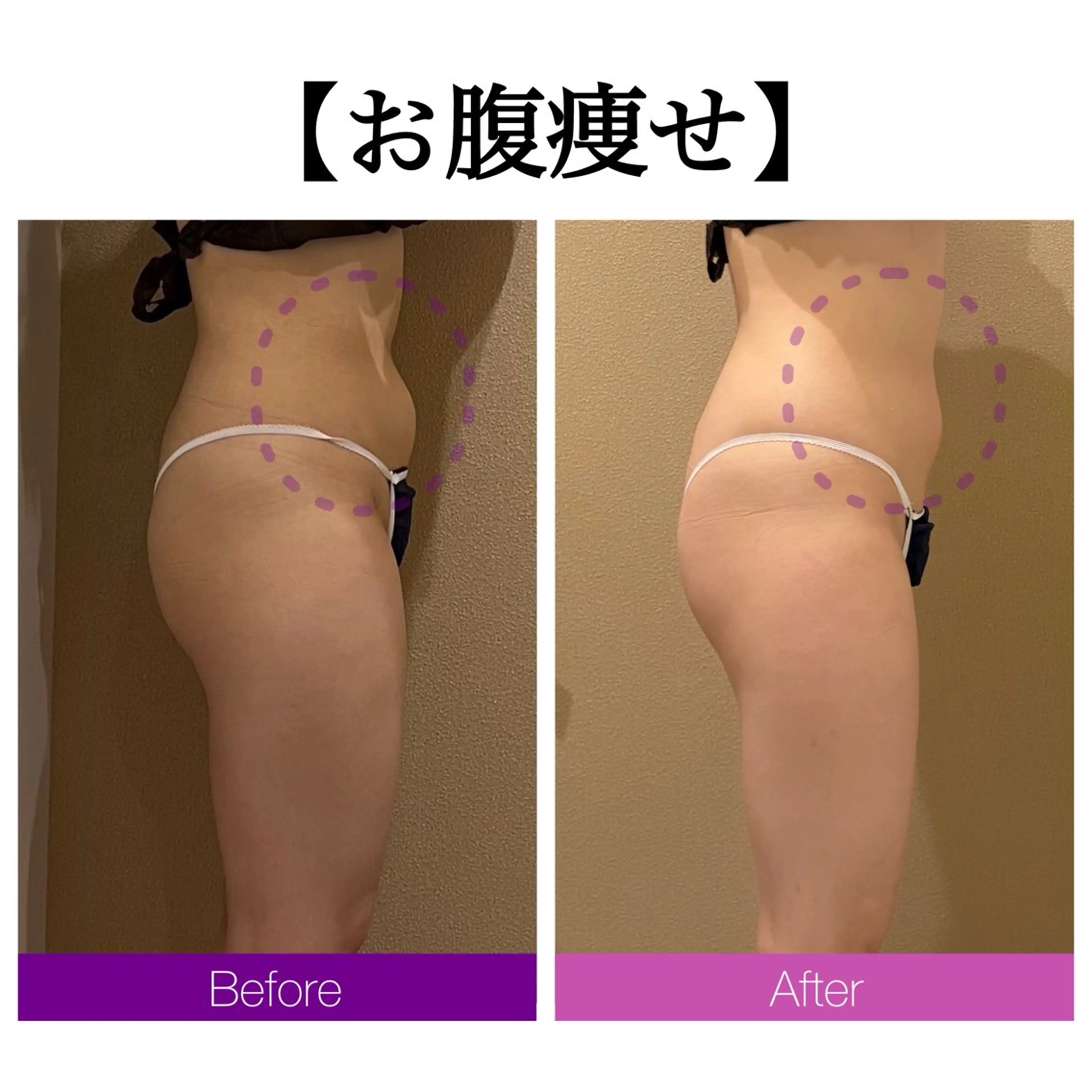 小顔コルギ ☆表参道/外苑前のエステ・リラクイメージ