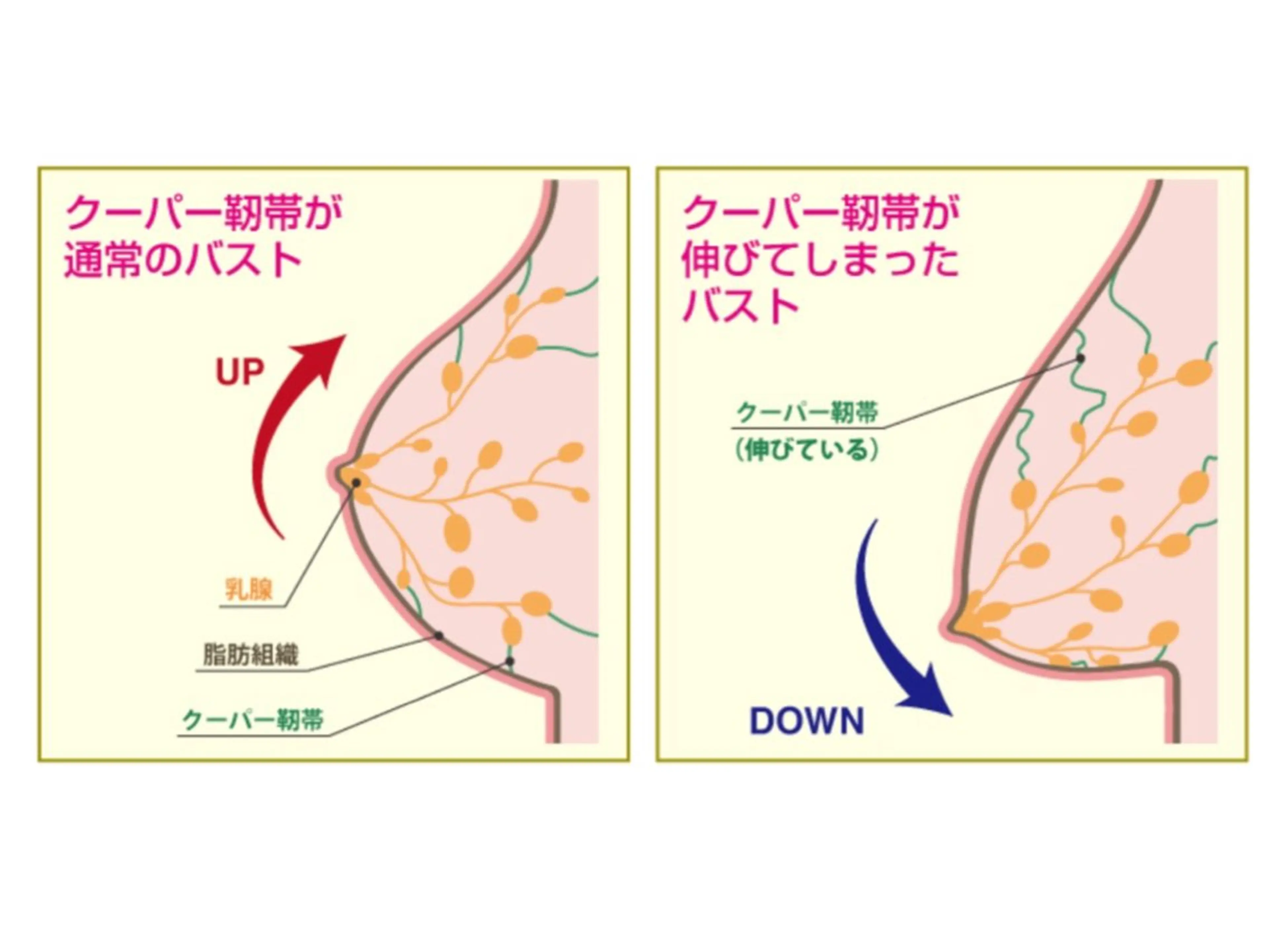産後・授乳後の下垂したバストを改善しますの写真