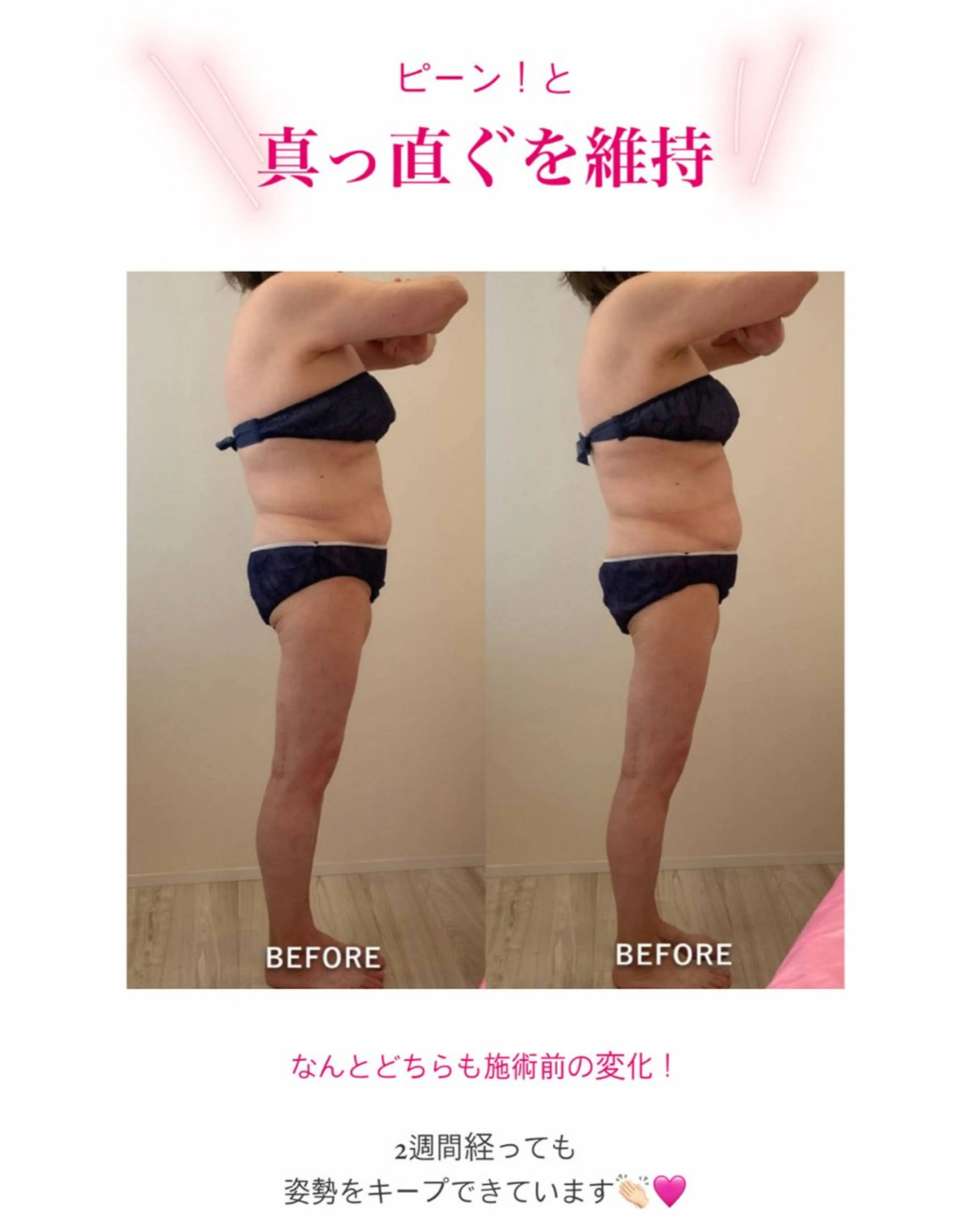 産後ダイエット−9㎏ Pourvous結衣のエステ・リラクイメージ