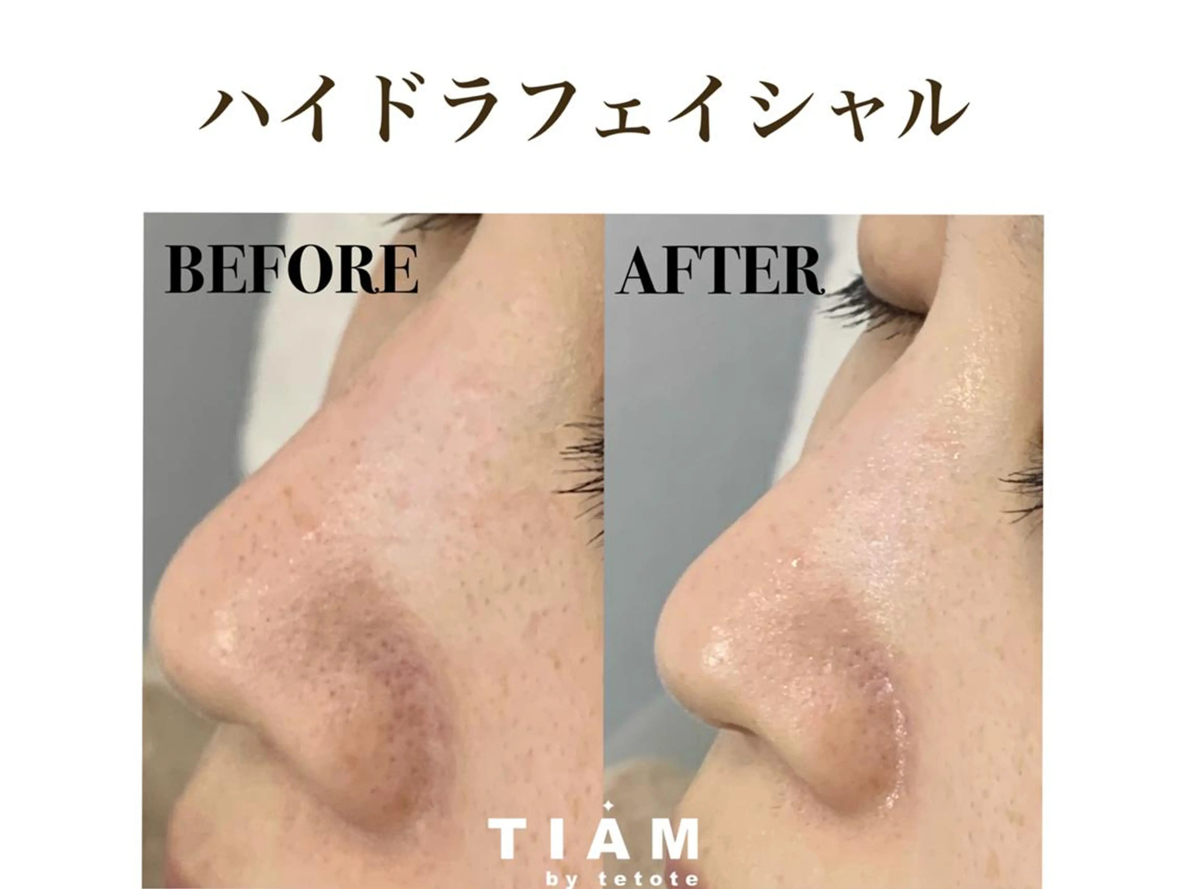 美肌サロンTIAM by tetoteのエステ・リラクイメージ