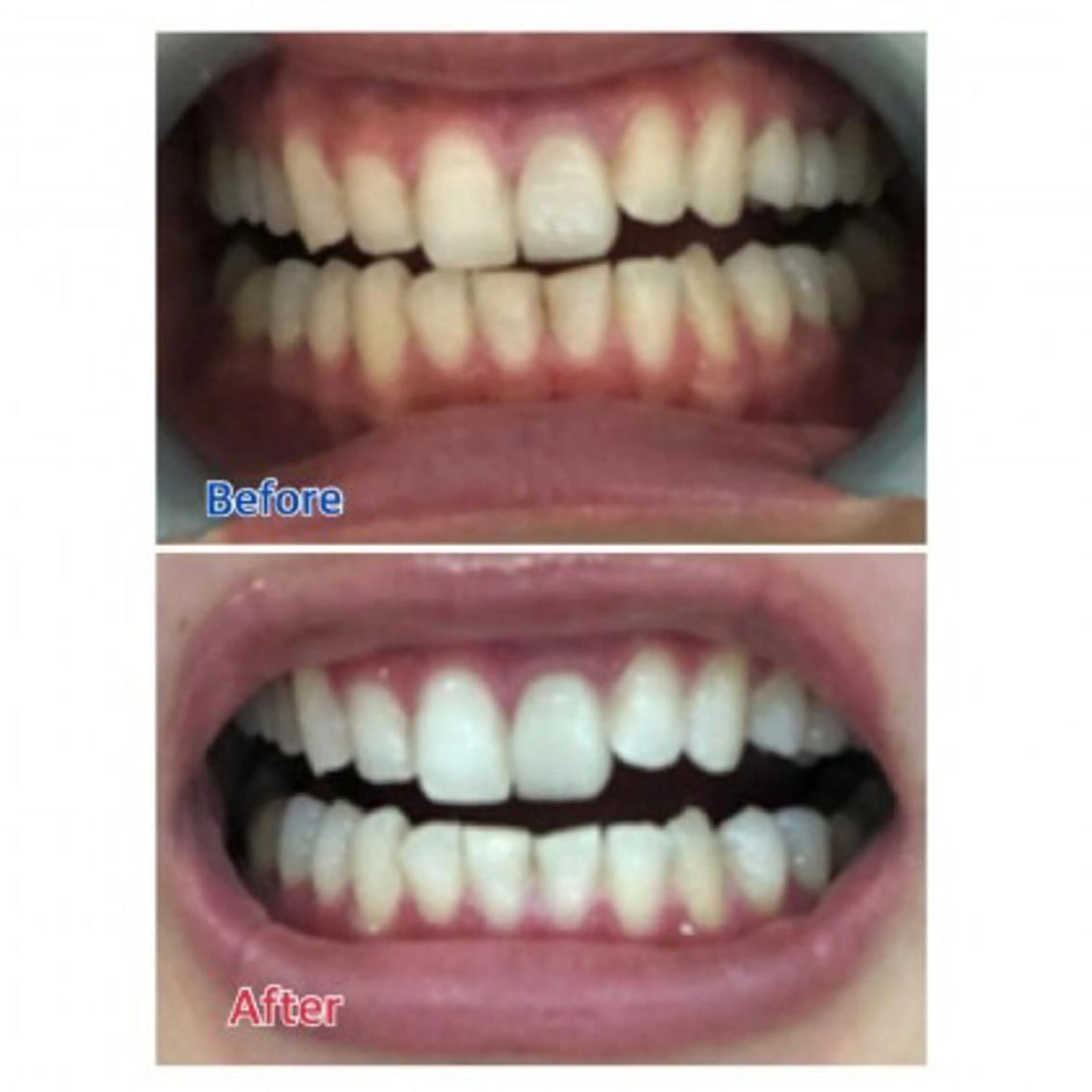 Ｍ渋谷 ホワイトニングのエステ・リラクイメージ