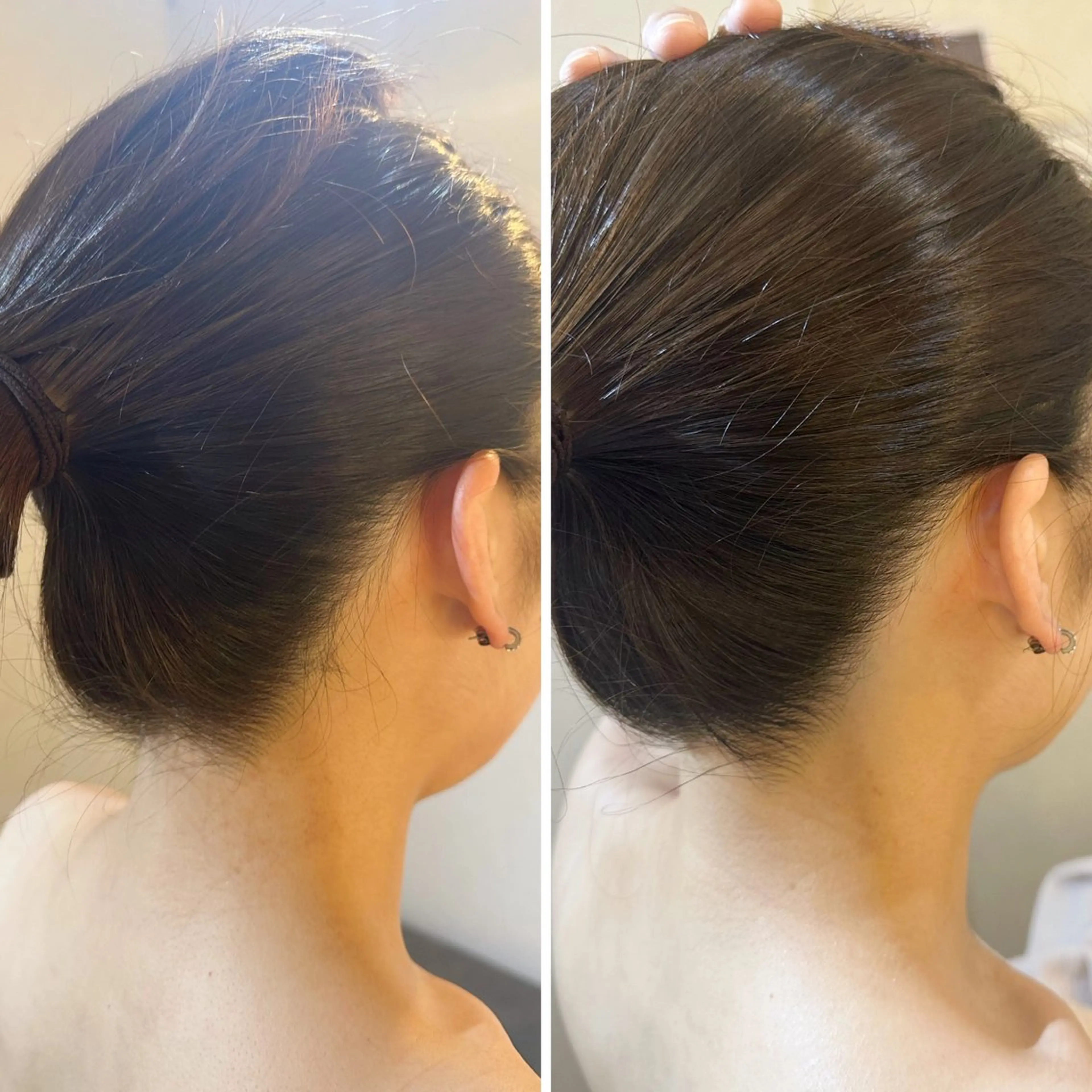 脱毛 うなじ脱毛/美肌脱毛 LABELのエステ・リラクイメージ