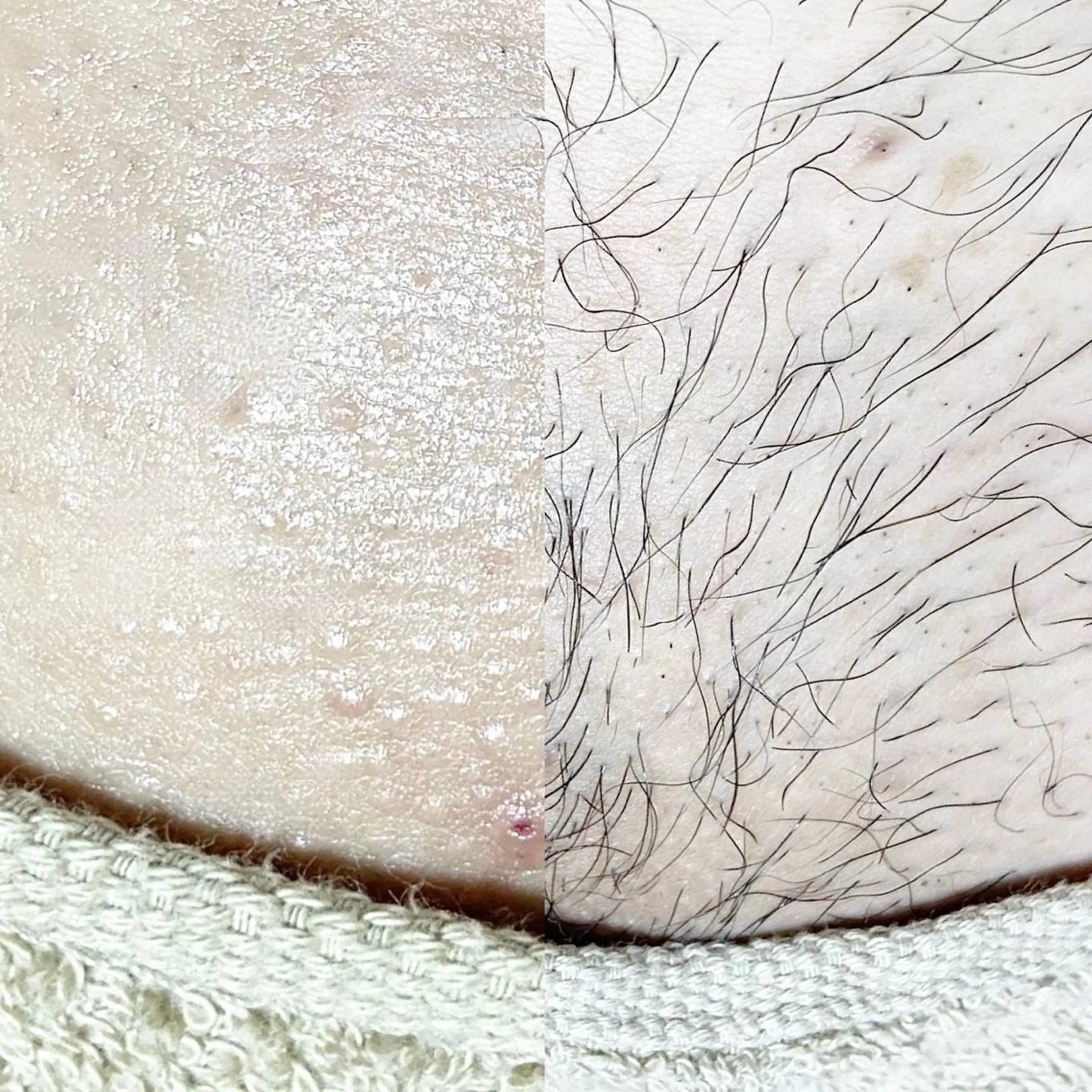 脱毛 &me ayakaのエステ・リラクイメージ