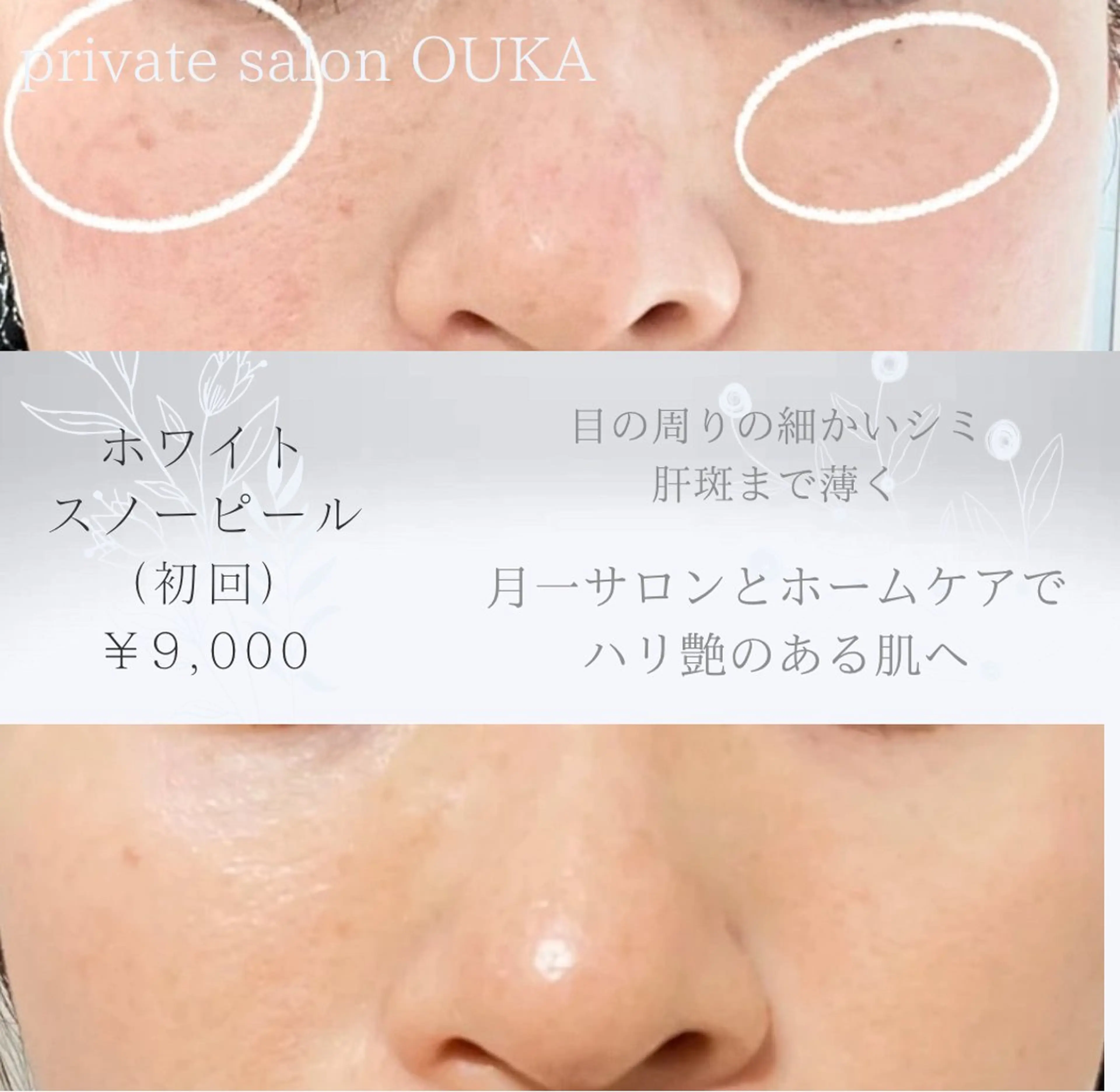 OUKA脱毛 毛穴ケアフェイシャルのエステ・リラクイメージ