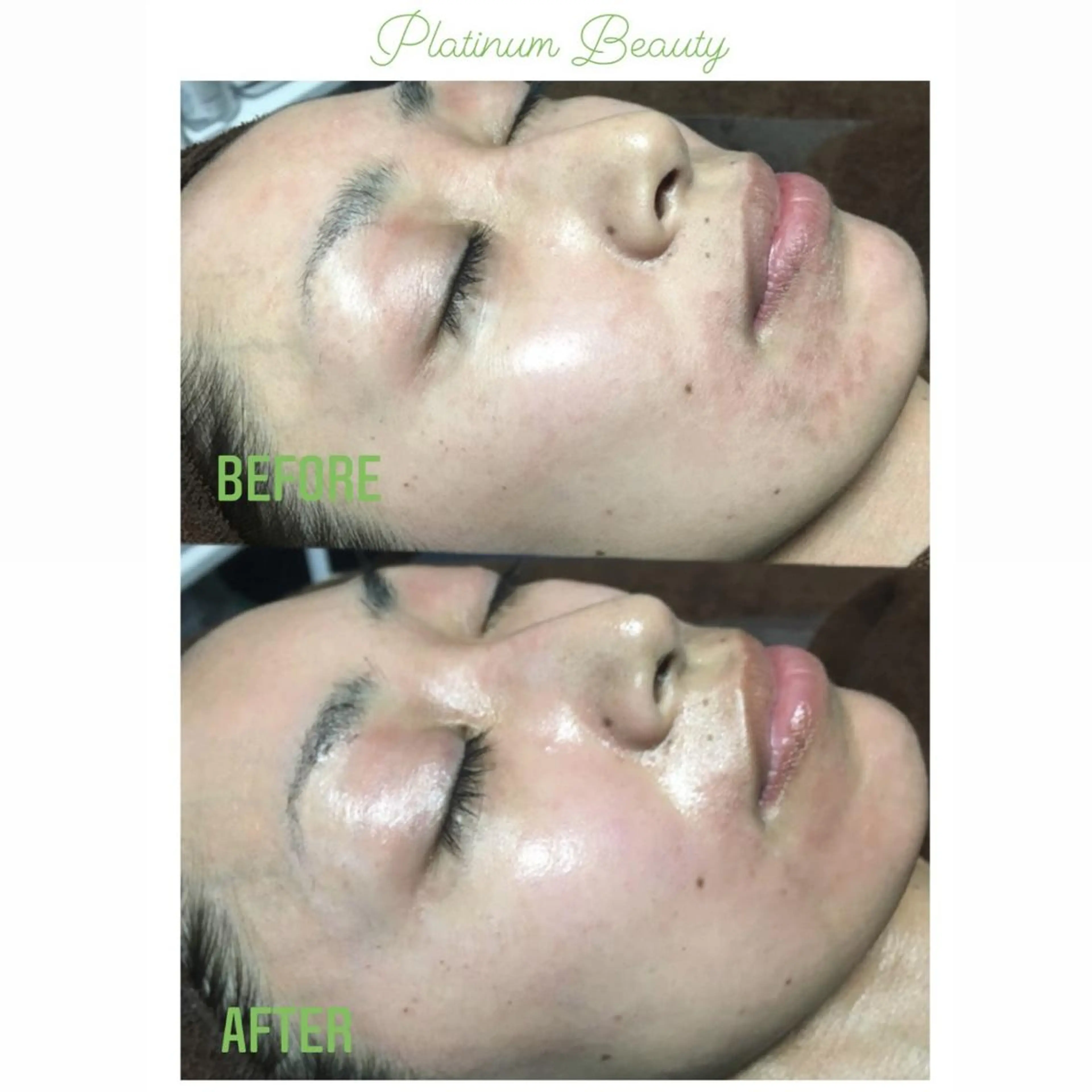 エステ プラティーヌ ボーテのその他イメージ