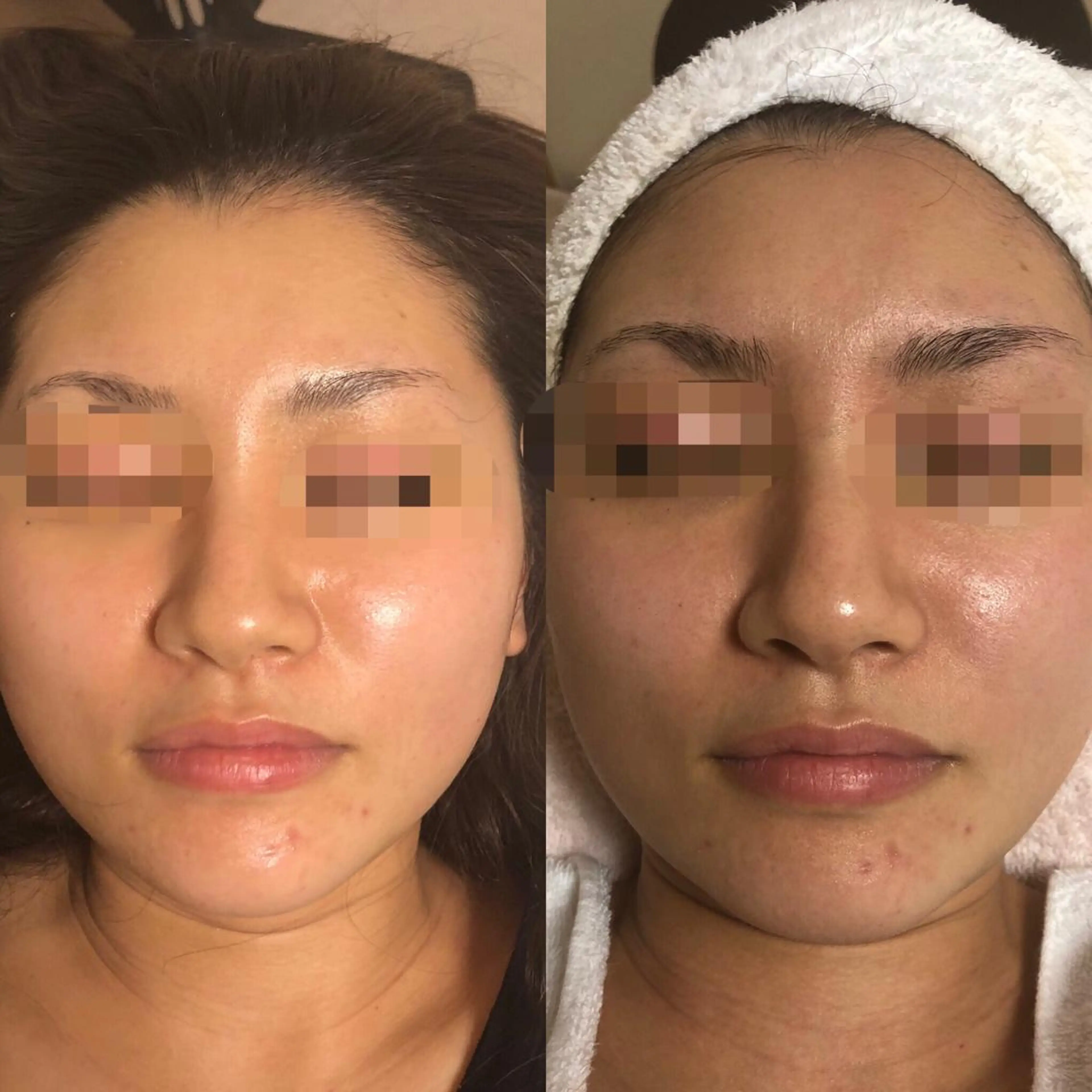 エステ エスカル ボーテのエステ・リラクイメージ