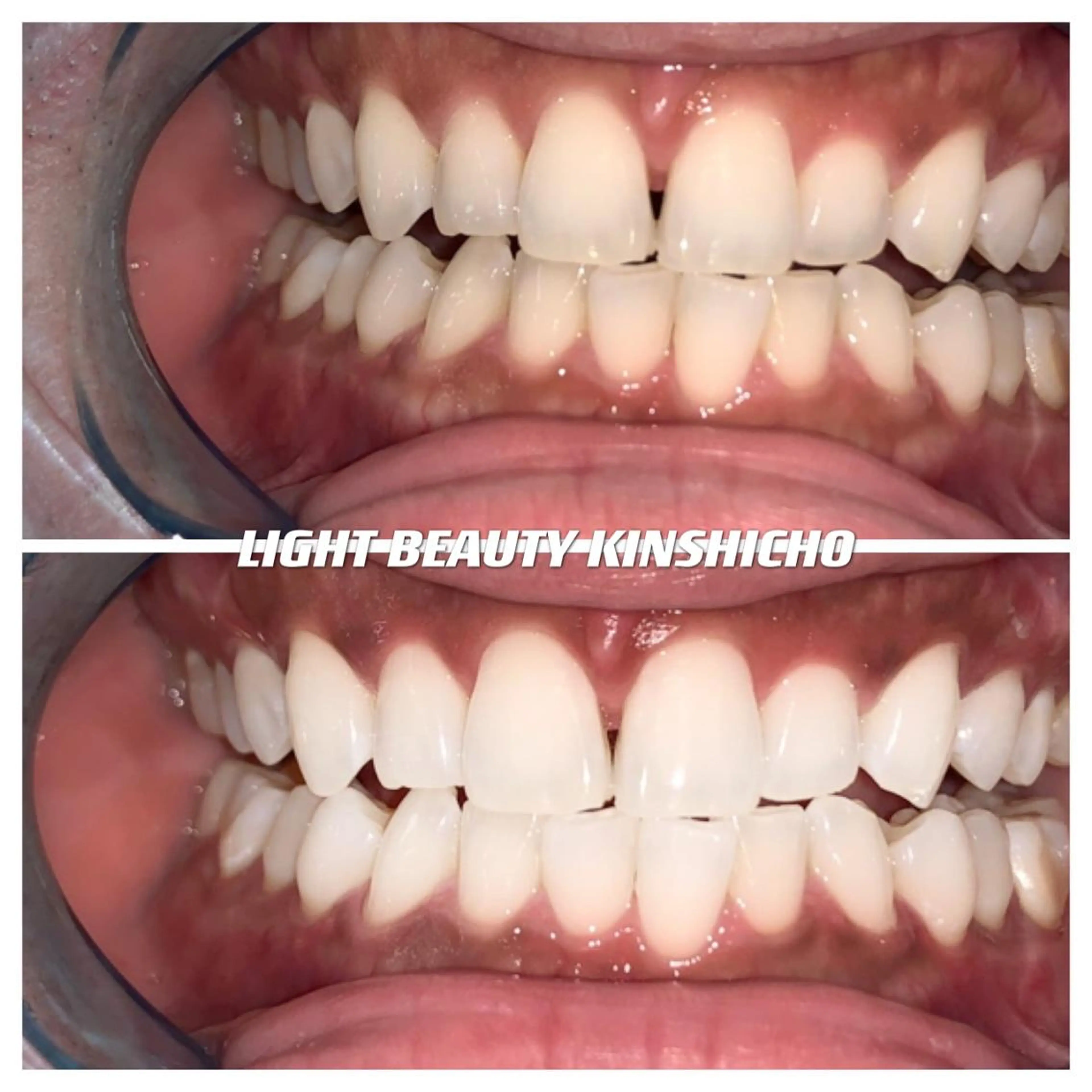 ライトビューティー 錦糸町店のエステ・リラクイメージ