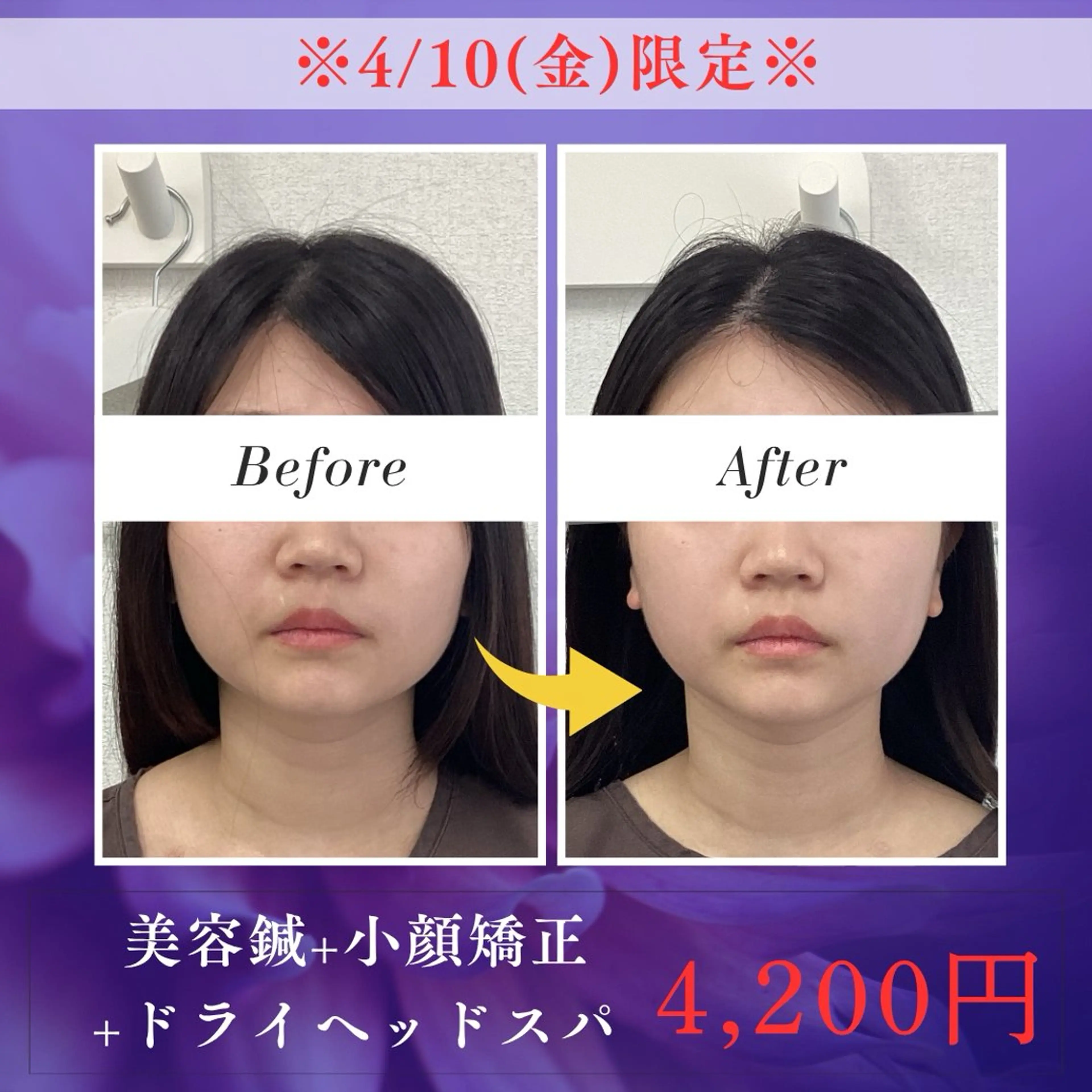 エステ リラク メディカルサロンドオフ所属・ハリサロンドオフ 美容鍼灸×小顔整体のエステ・リラクイメージ