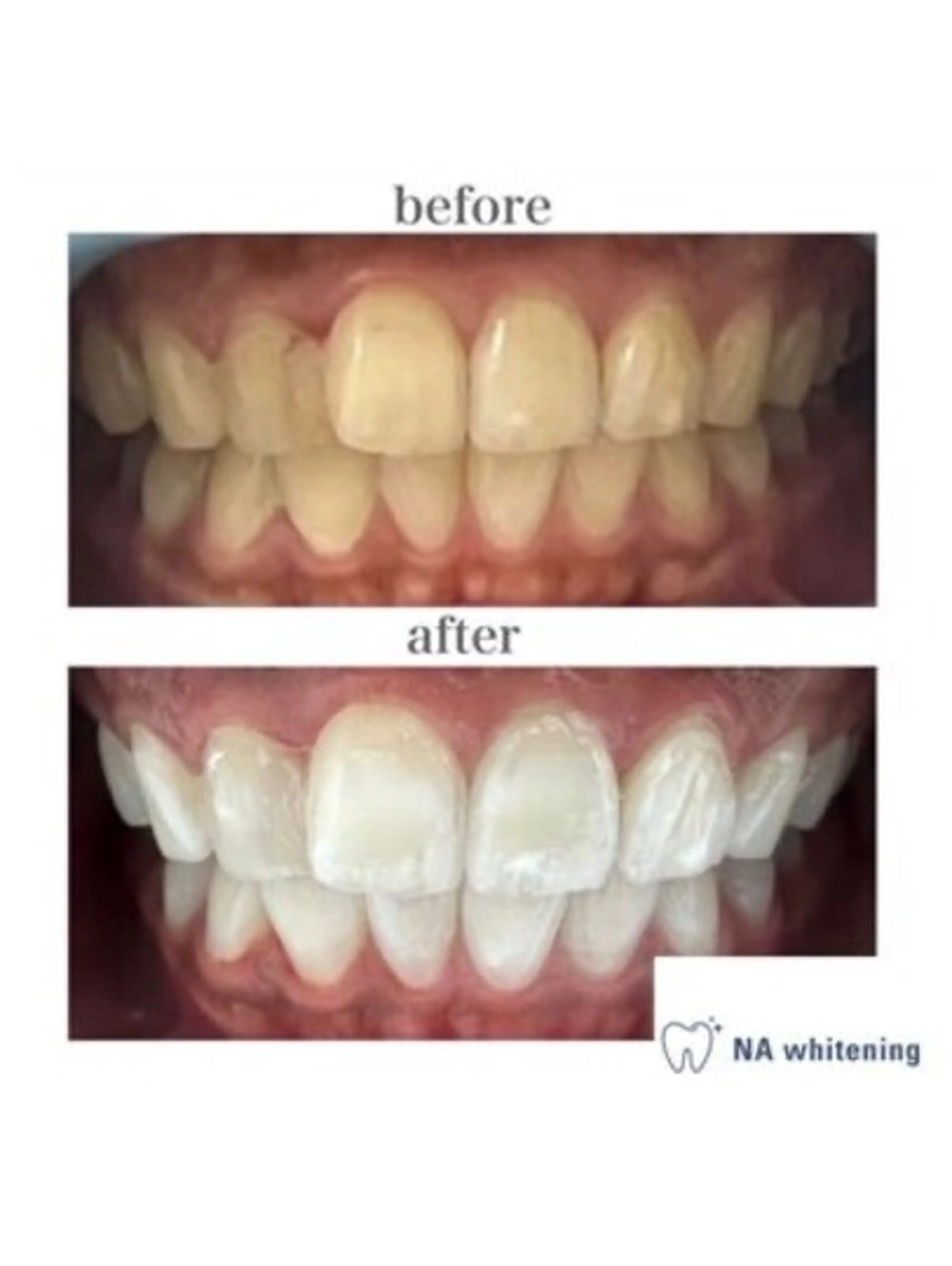 メンズ NAホワイトニング /自由が丘のエステ・リラクイメージ