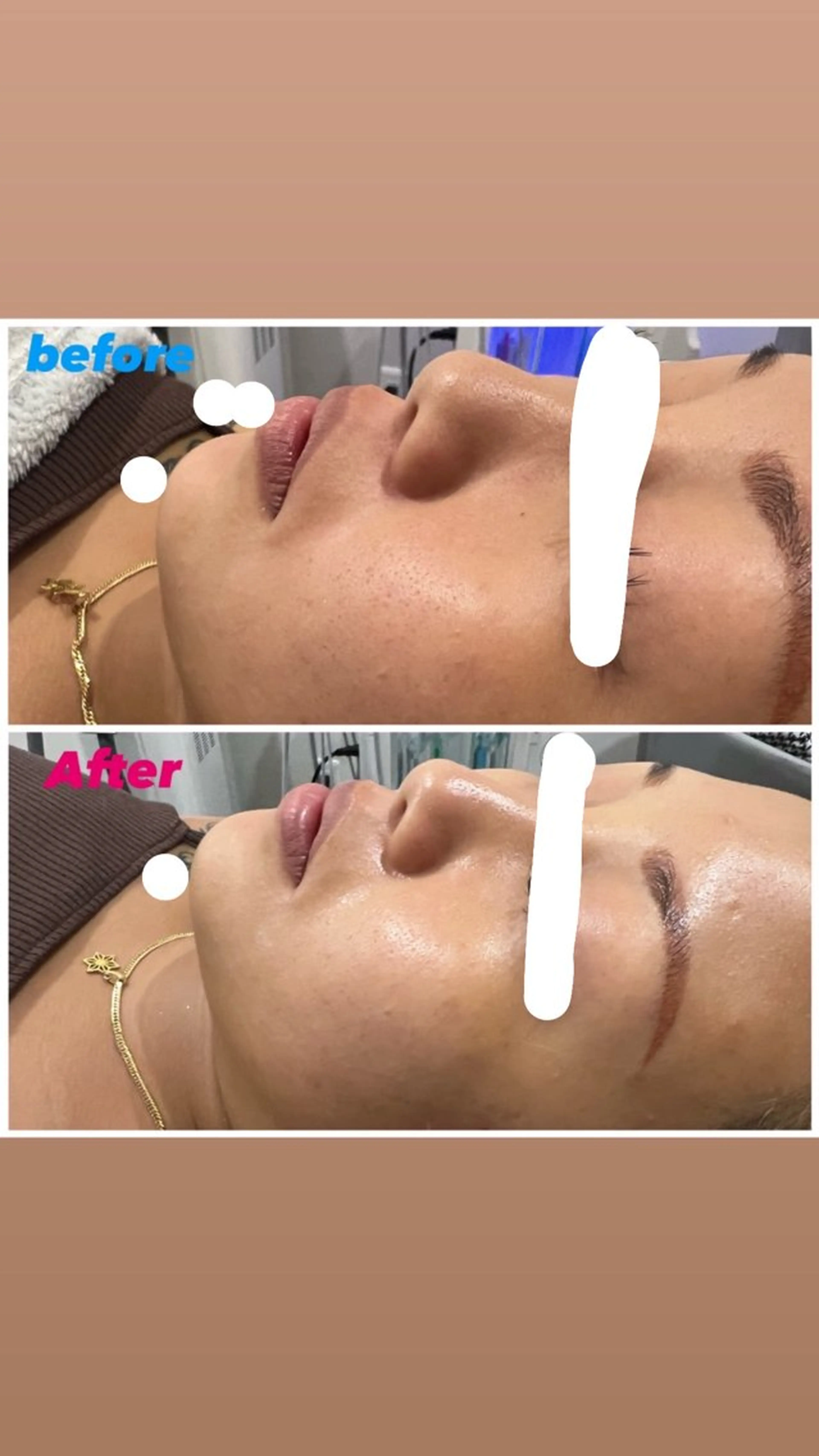 痩身/毛穴洗浄/脱毛 アルカンジュのエステ・リラクイメージ