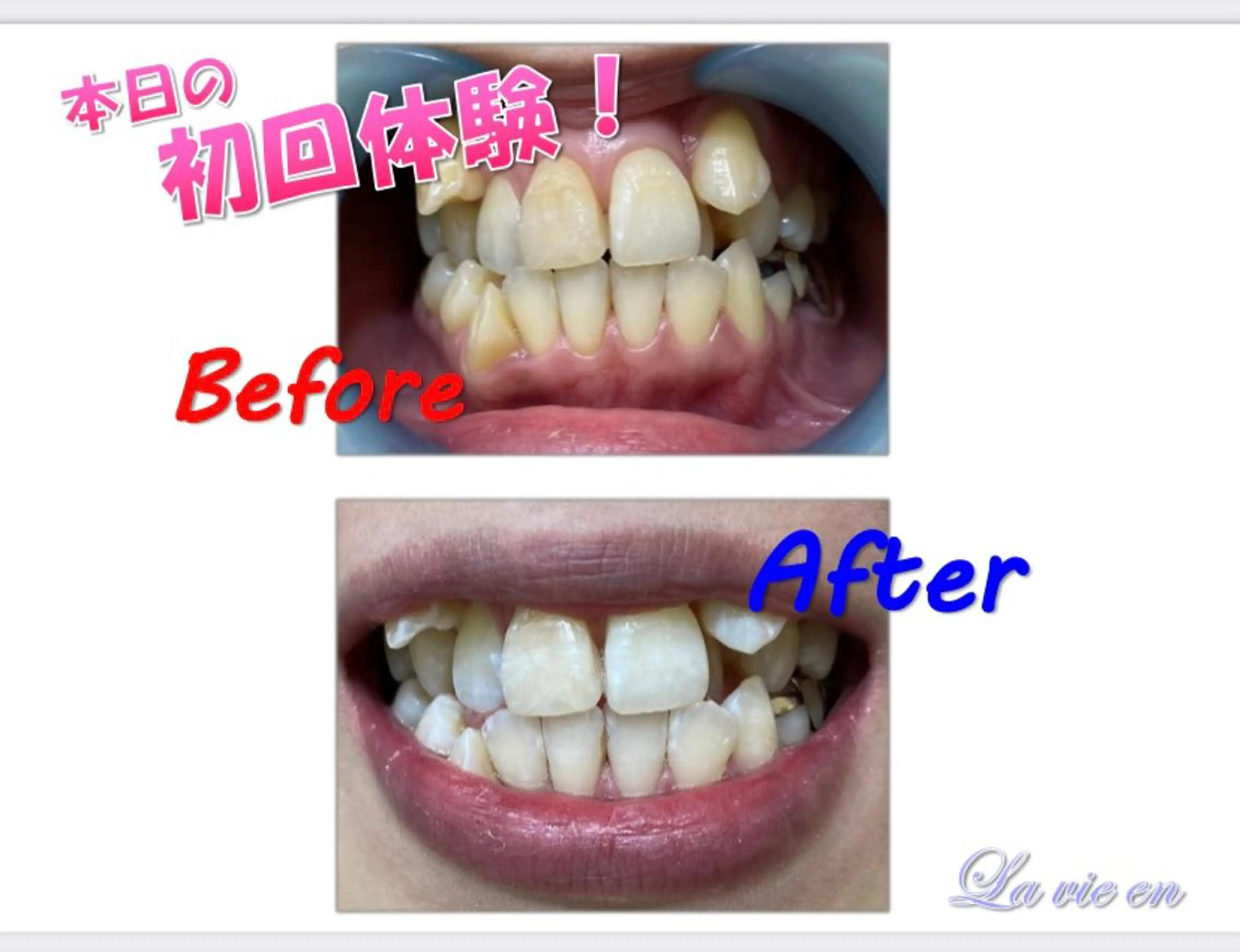 その他 セルフホワイトニングサロン　ラヴィアン所属・ホワイトニングサロン La vie enのその他イメージ