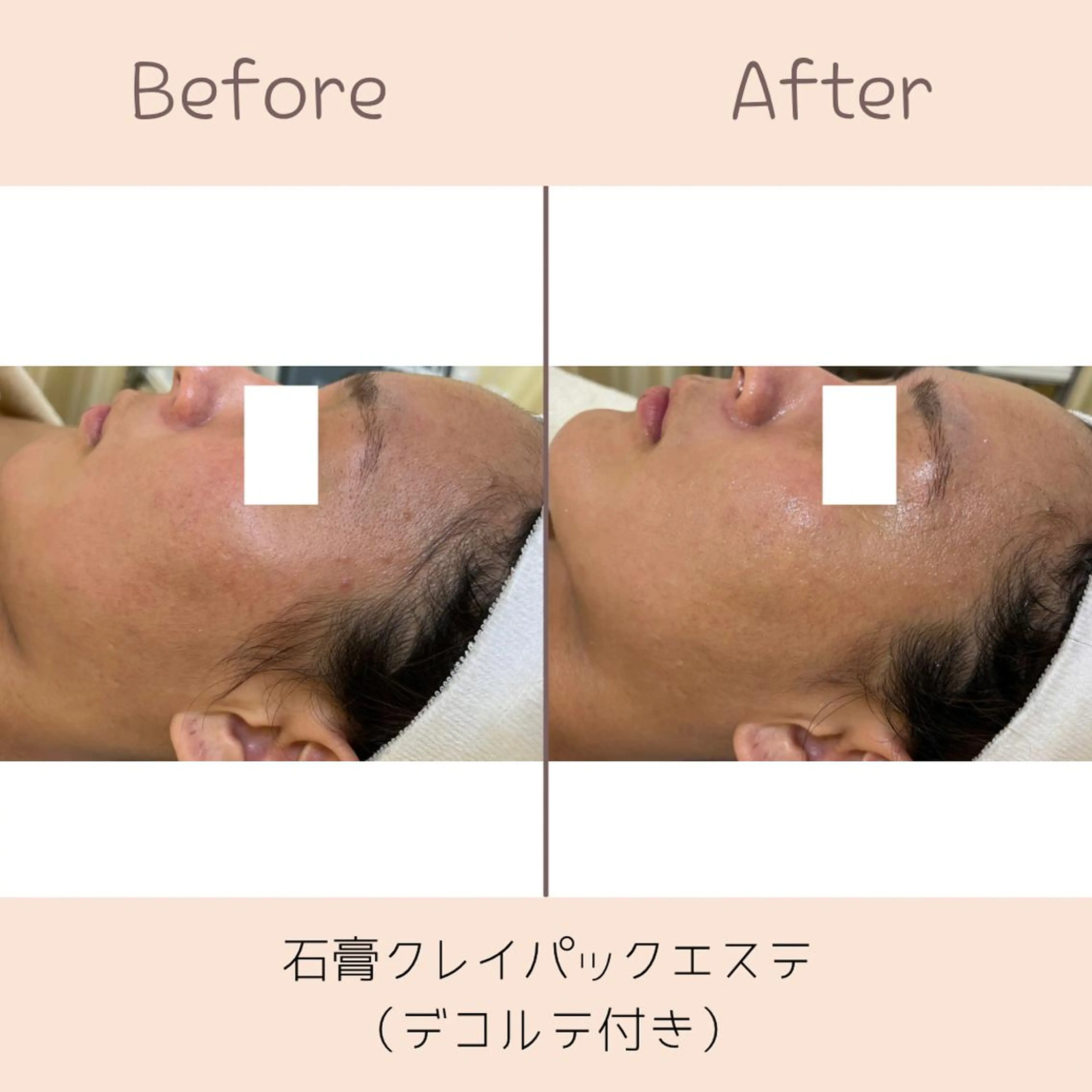 西村 優稀子のエステ・リラクイメージ