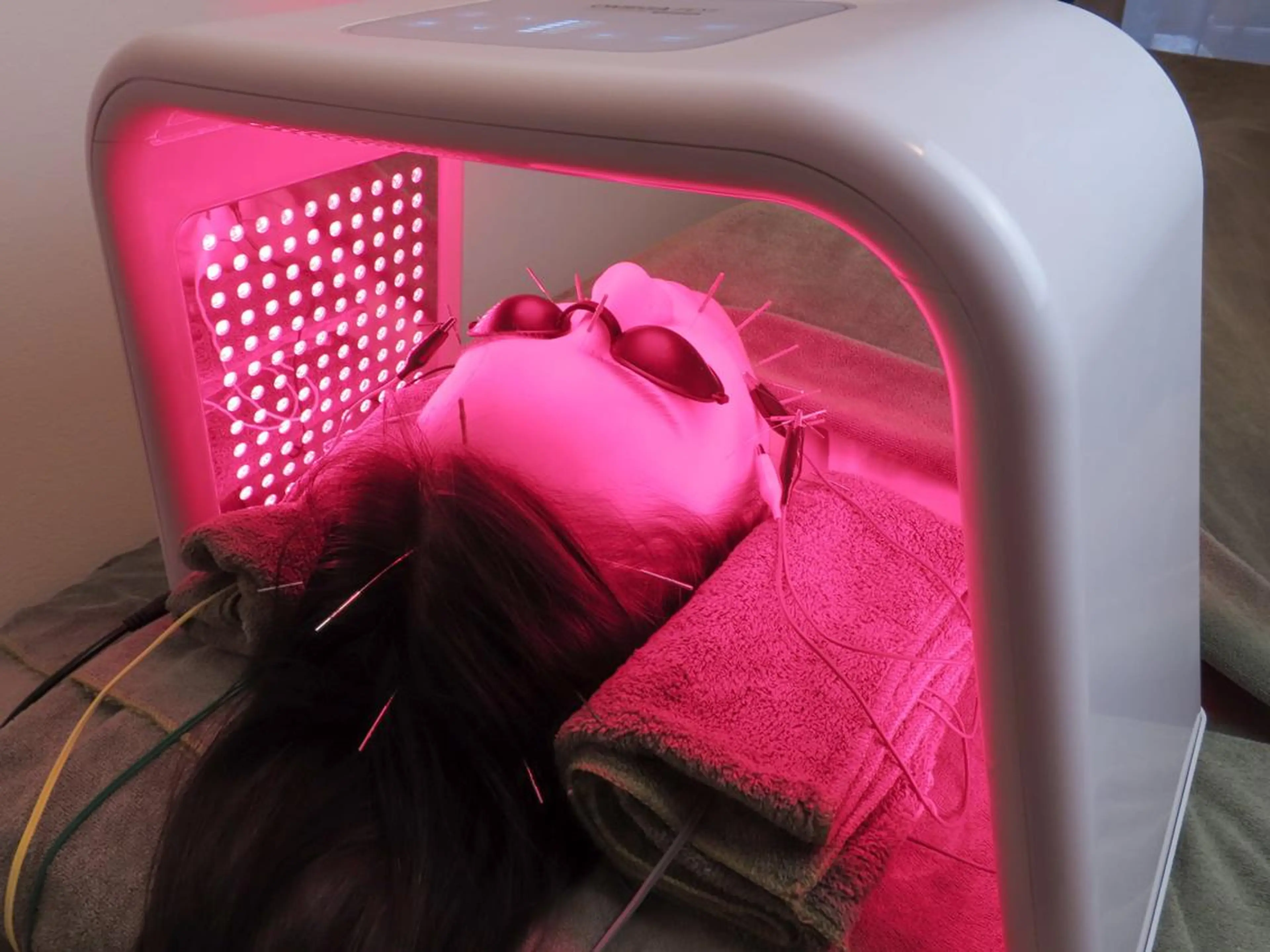 エステ リラク 美容とカラダの鍼灸 サロン やなけんのエステ・リラクイメージ