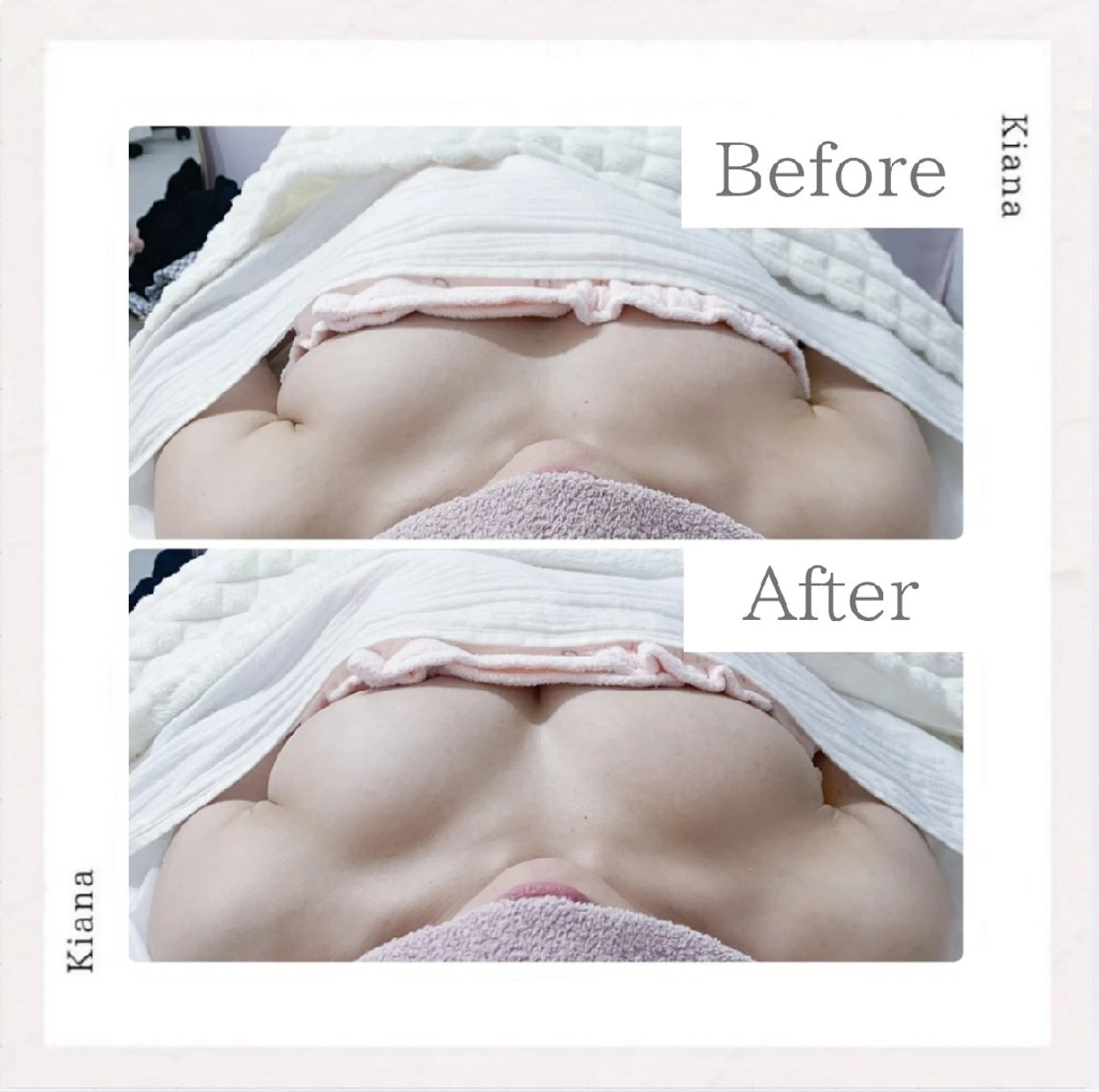 エステ リラク 【バスト専門店 】 Kiana のエステ・リラクイメージ