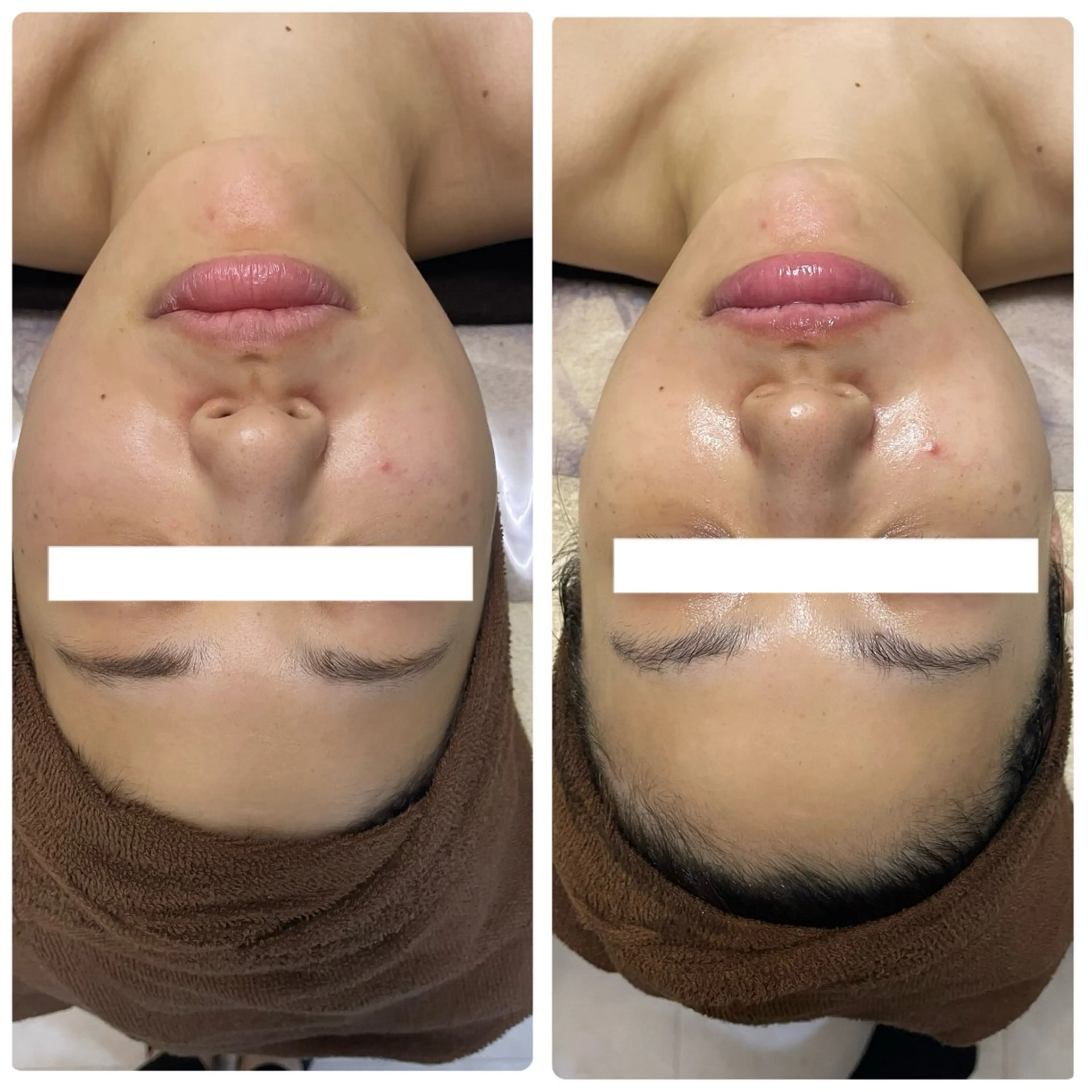 スッキリ小顔‼️(ヘッドマッサージ付き)の写真