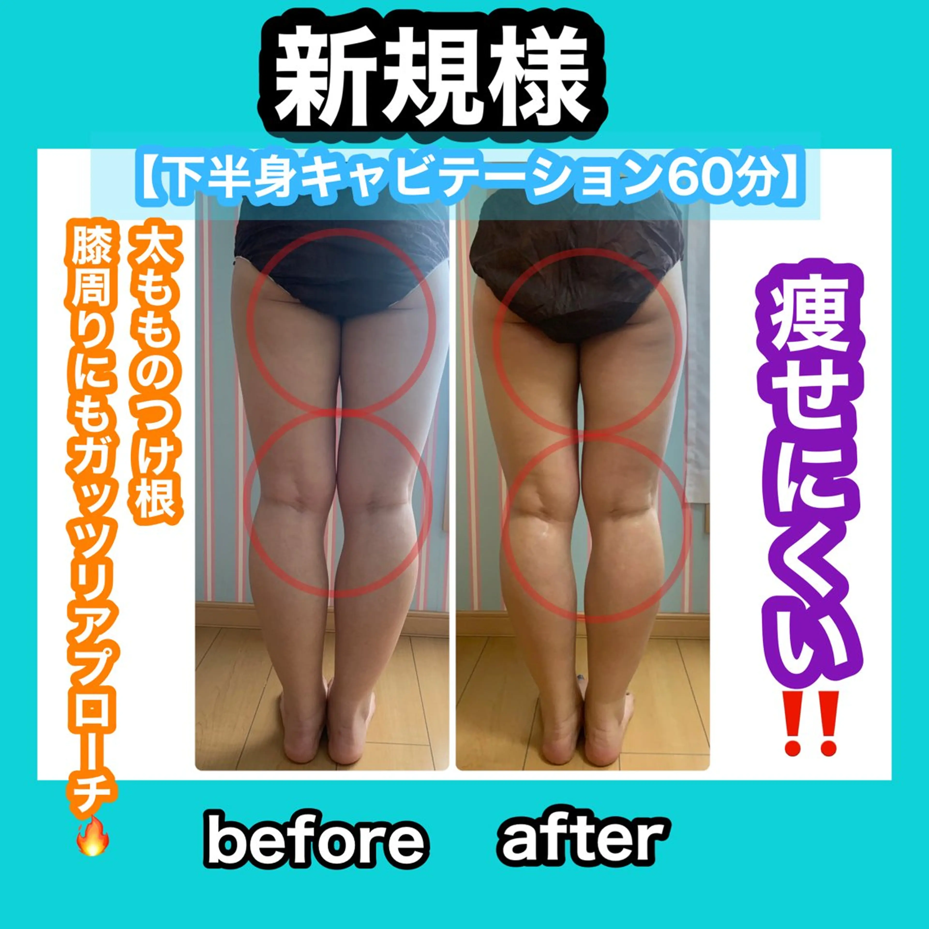 エステ リラク 痩身/脱毛/ネイル HARUKAのエステ・リラクイメージ