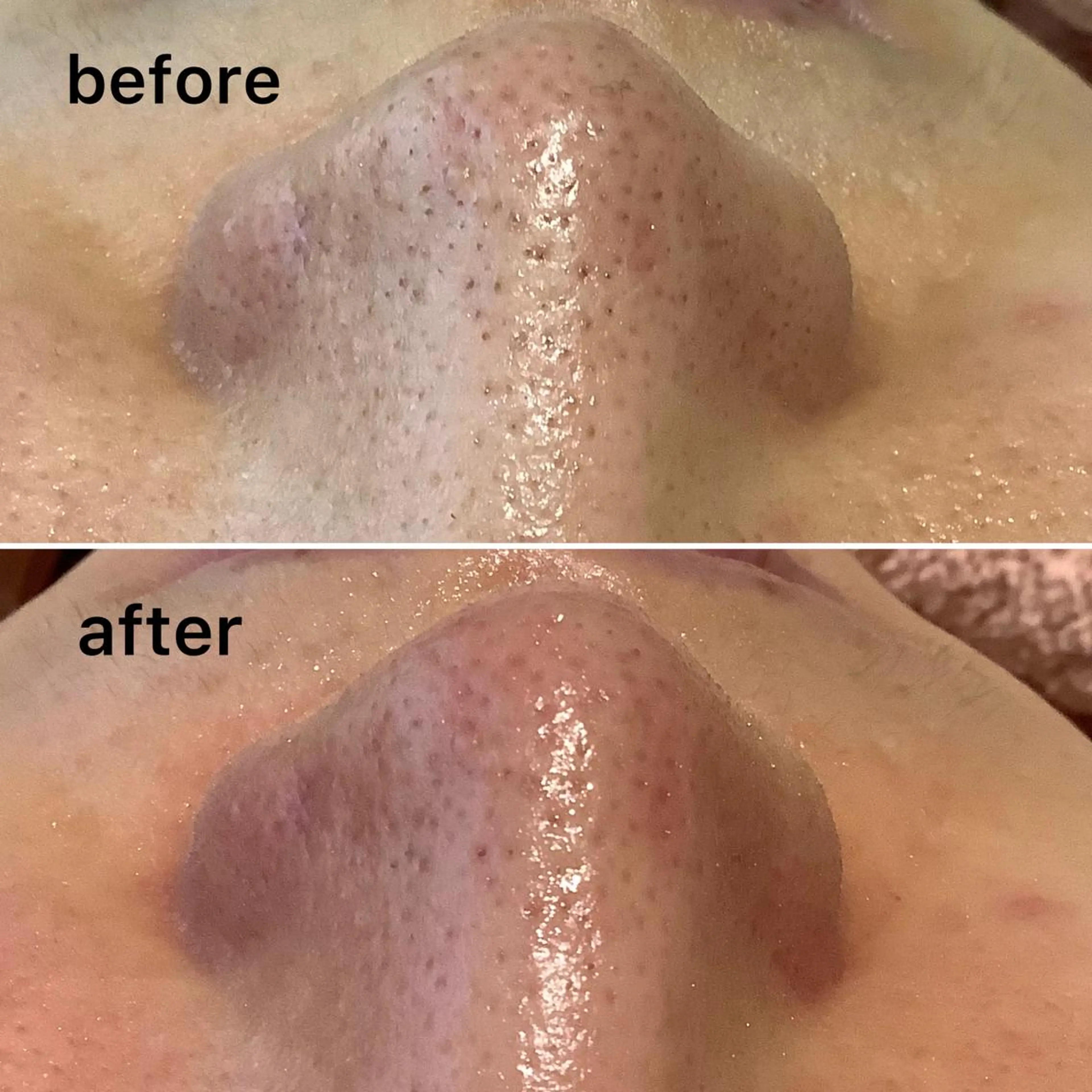 エステ 脱毛&エステサロン JIGGLY☆松田のエステ・リラクイメージ