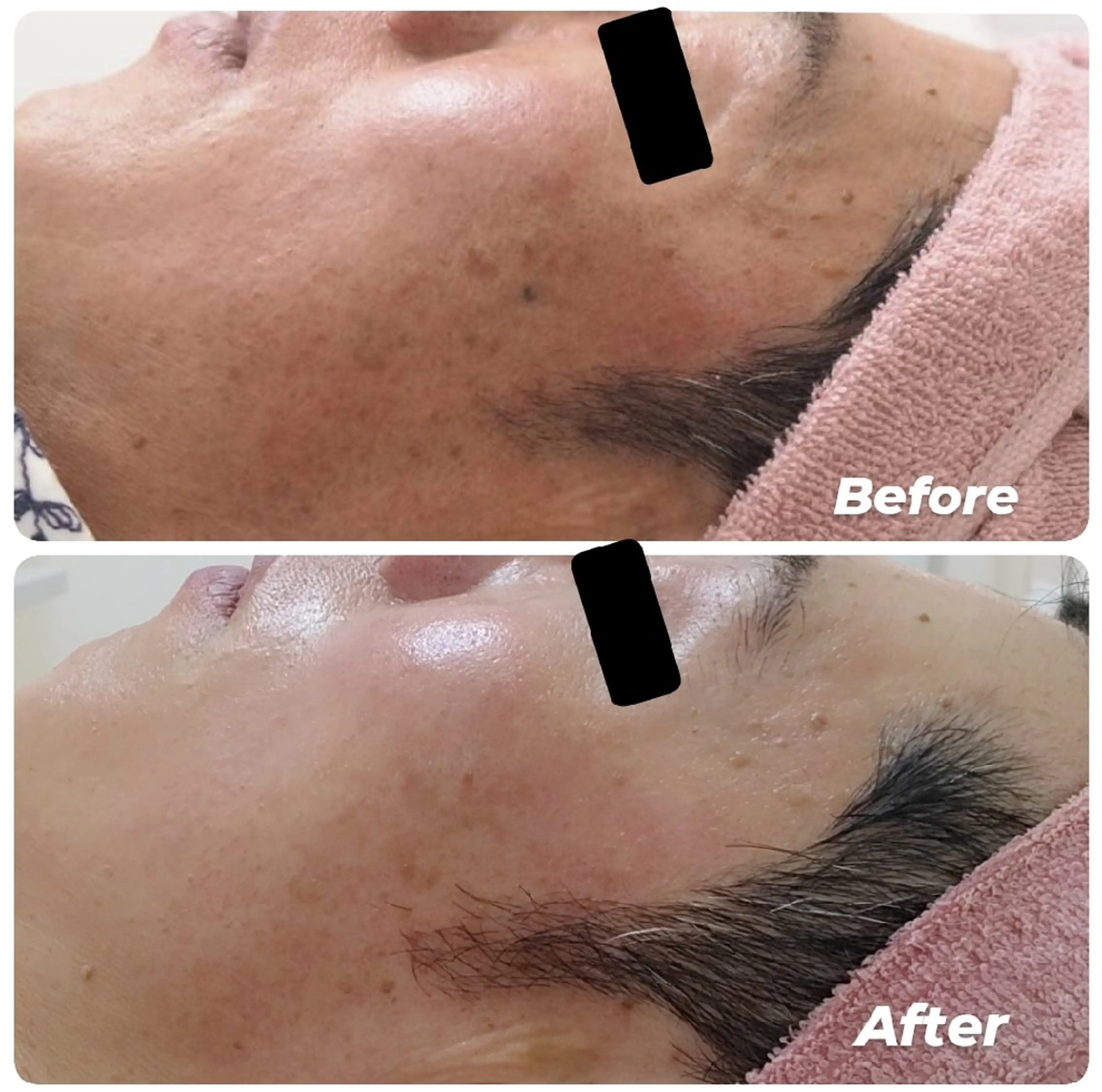 佐賀 痩身・美肌 @uni.clearのエステ・リラクイメージ