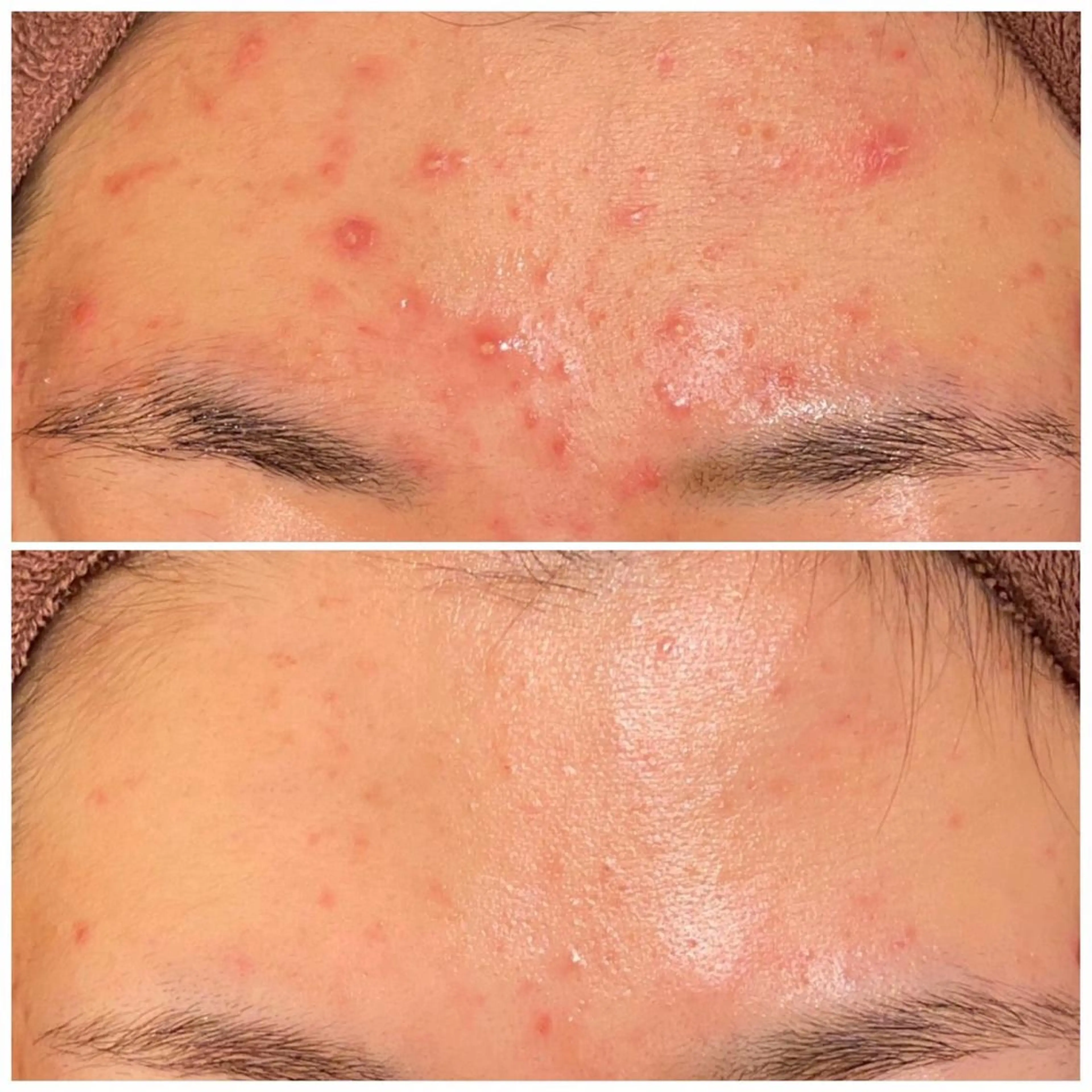 セミロング カラー パーマ ヘアアレンジ メンズ キッズ ネイル マツエク・マツパ アイブロウ ニキビ特化型エステ 🍋最短で肌質改善のエステ・リラクイメージ