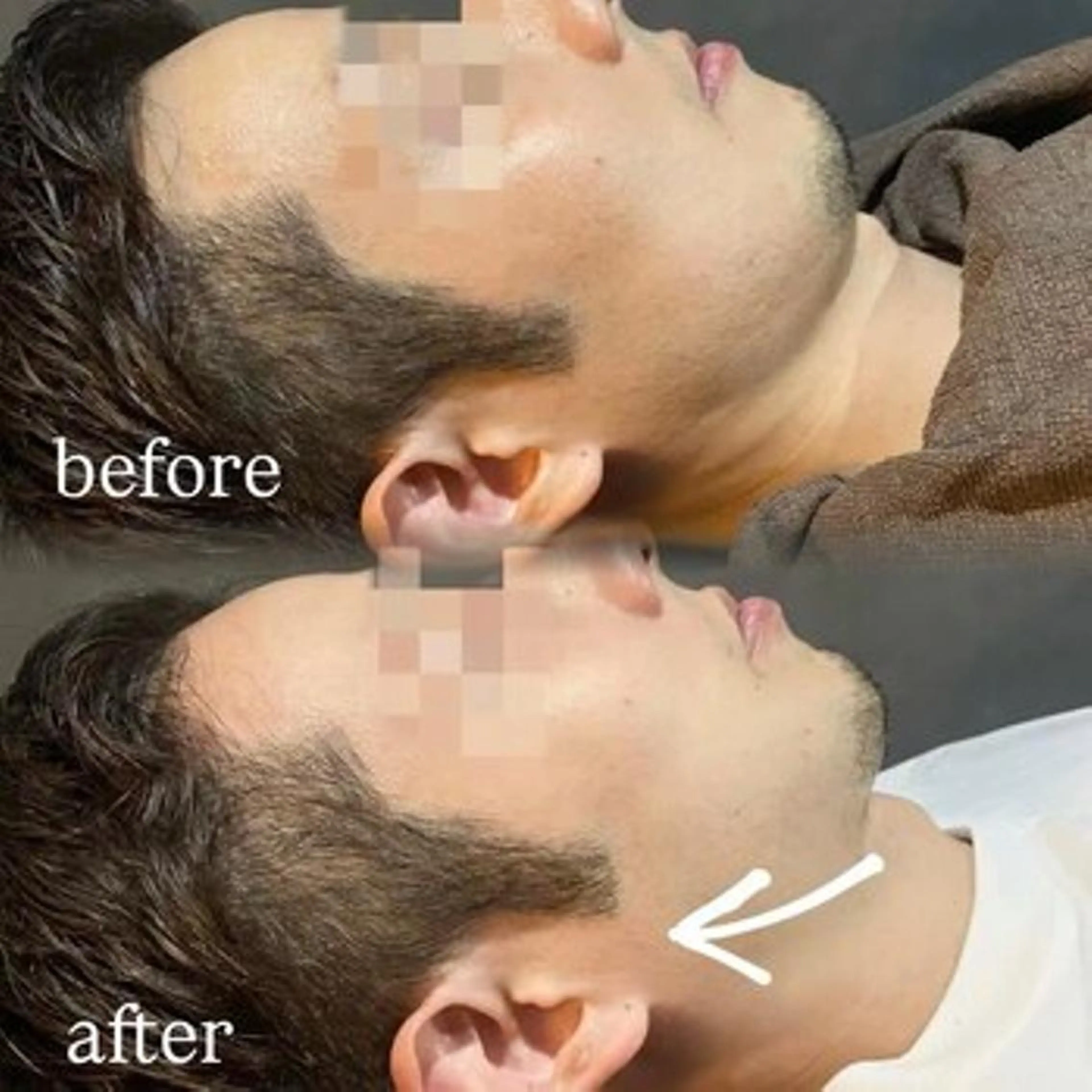 エステ 🪞Purasia. 🫧韓国肌管理💎のエステ・リラクイメージ