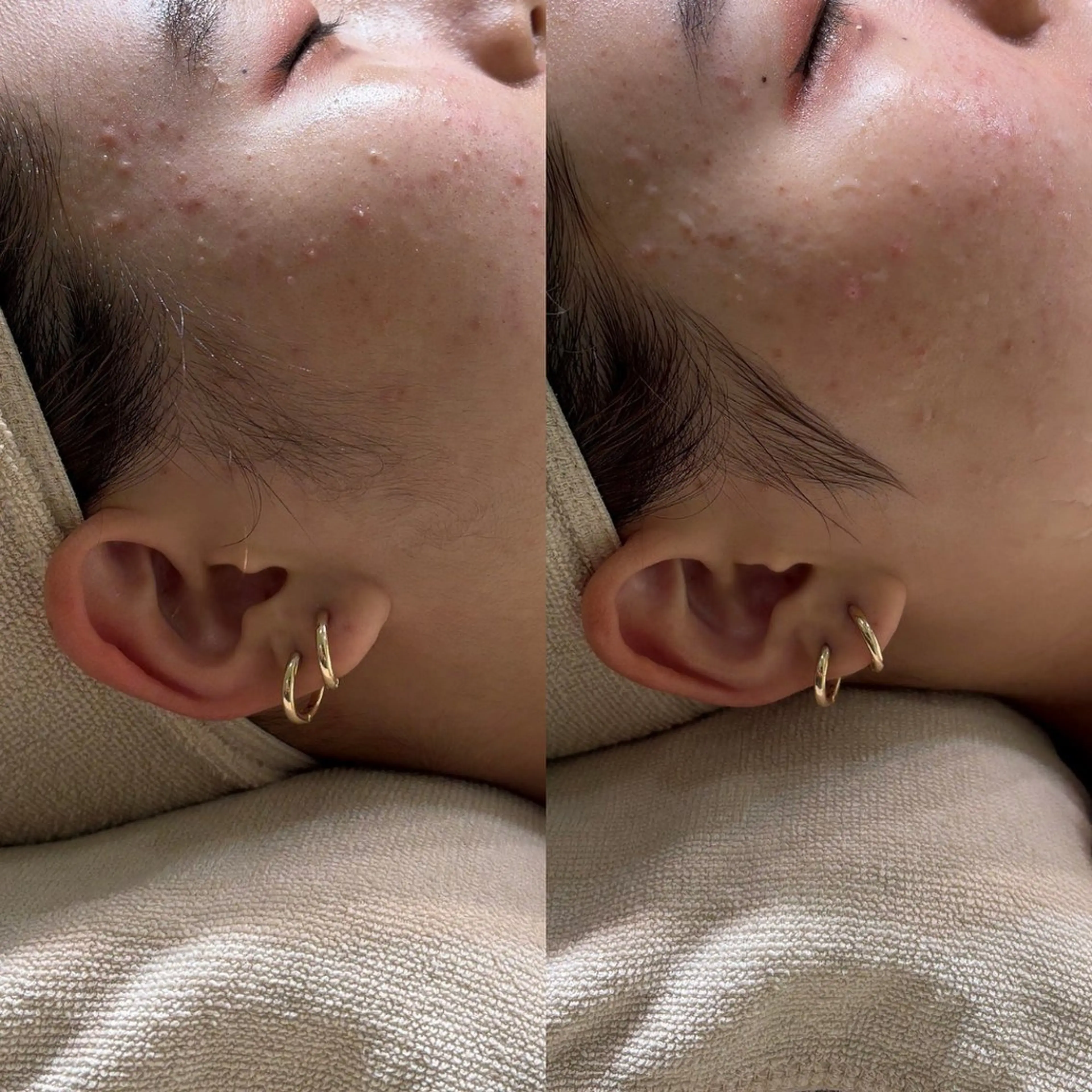 エステ リラク 島村 萌依のその他イメージ