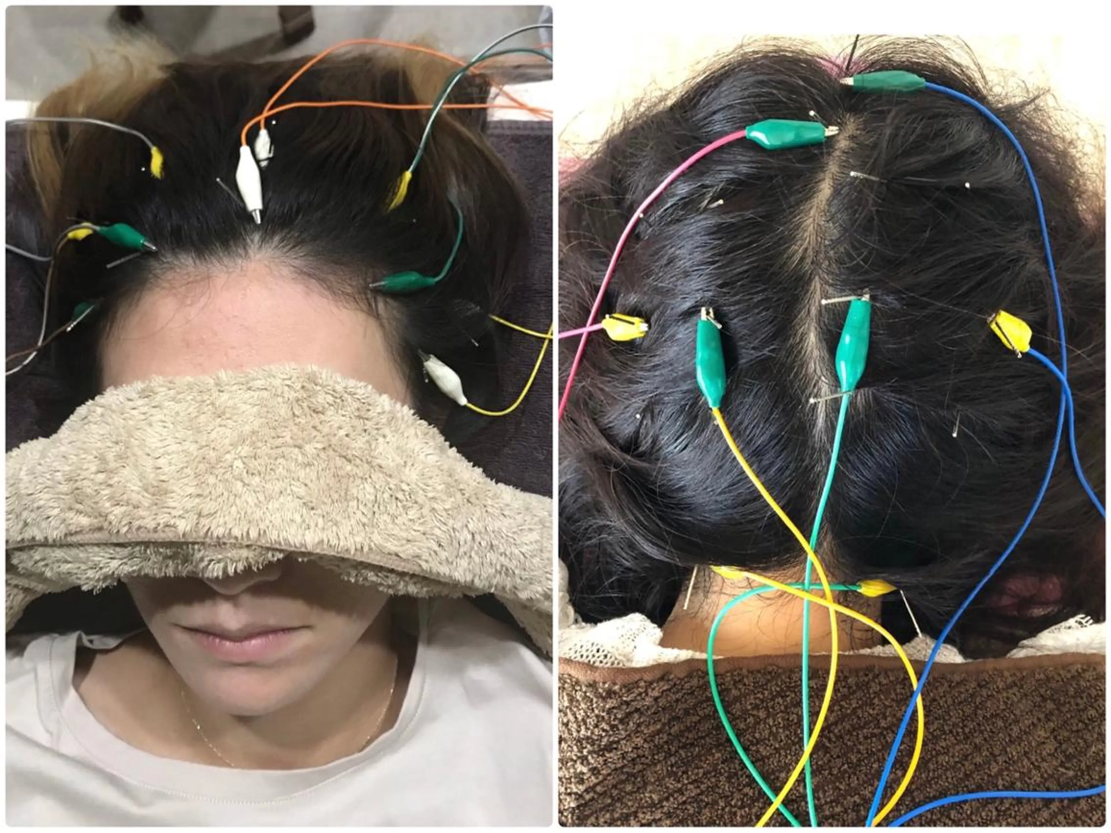 かすがい鍼灸院 Re.heartのエステ・リラクイメージ