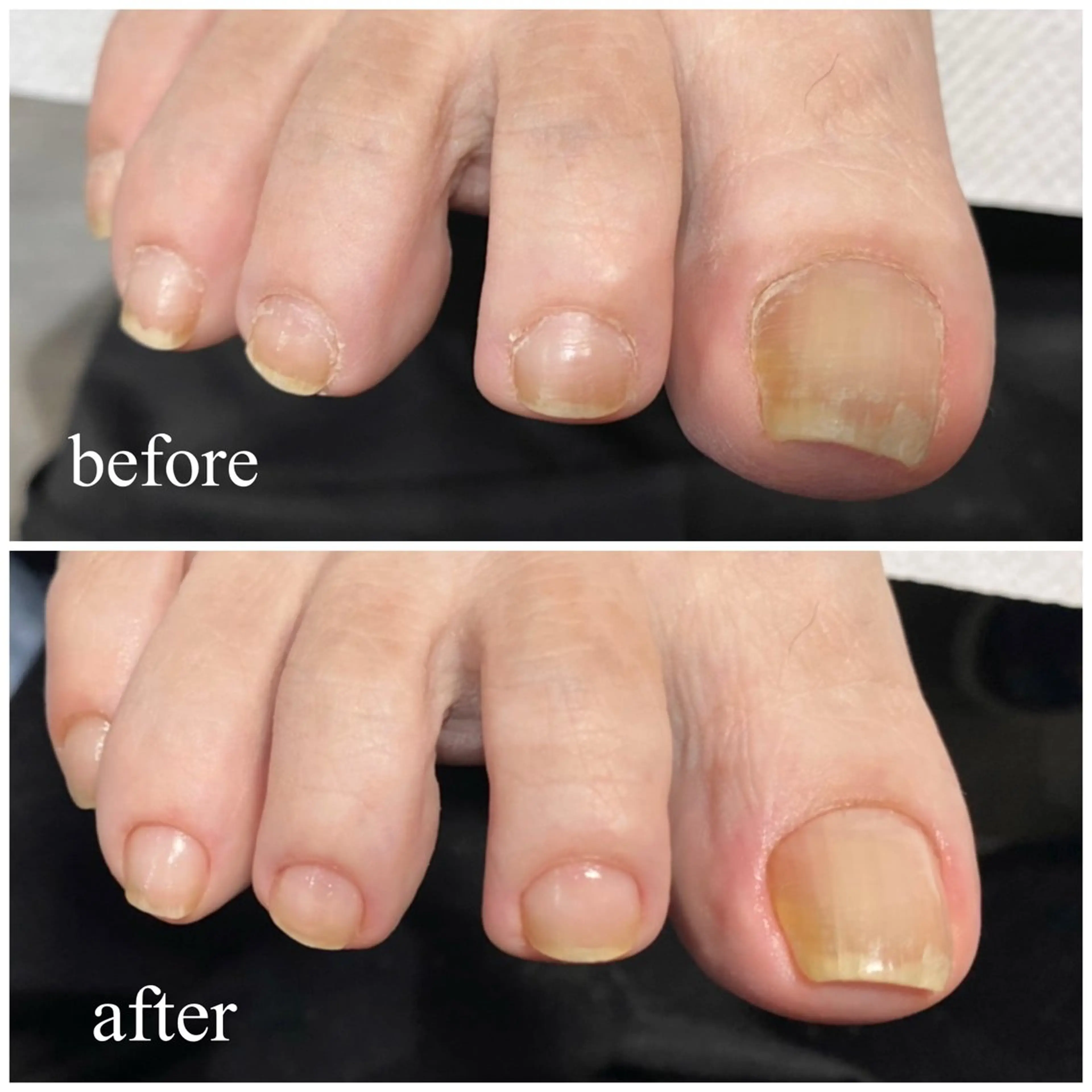 フットケアの写真