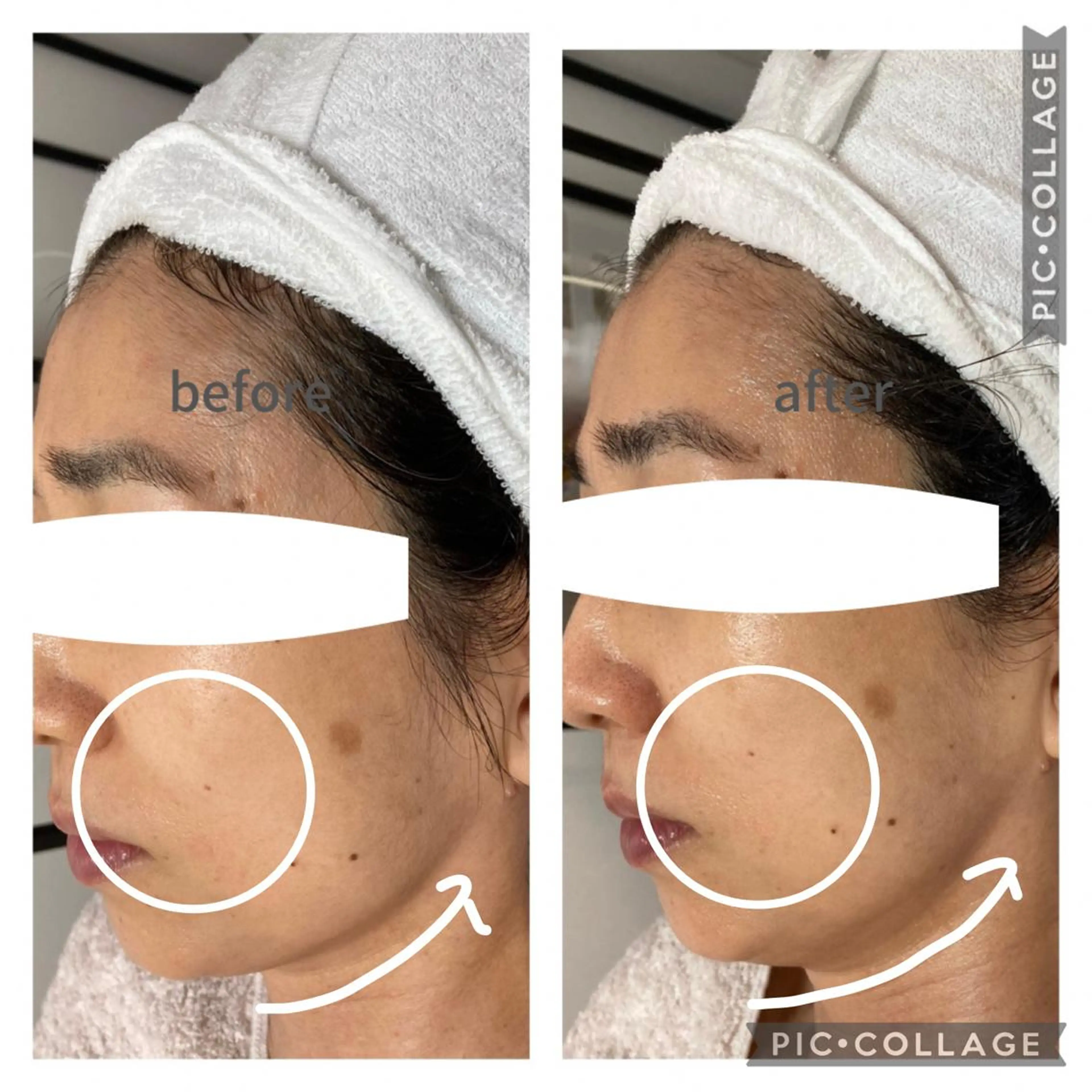 【２回目、3回目ご来店の方】ベーシックフルエステの写真