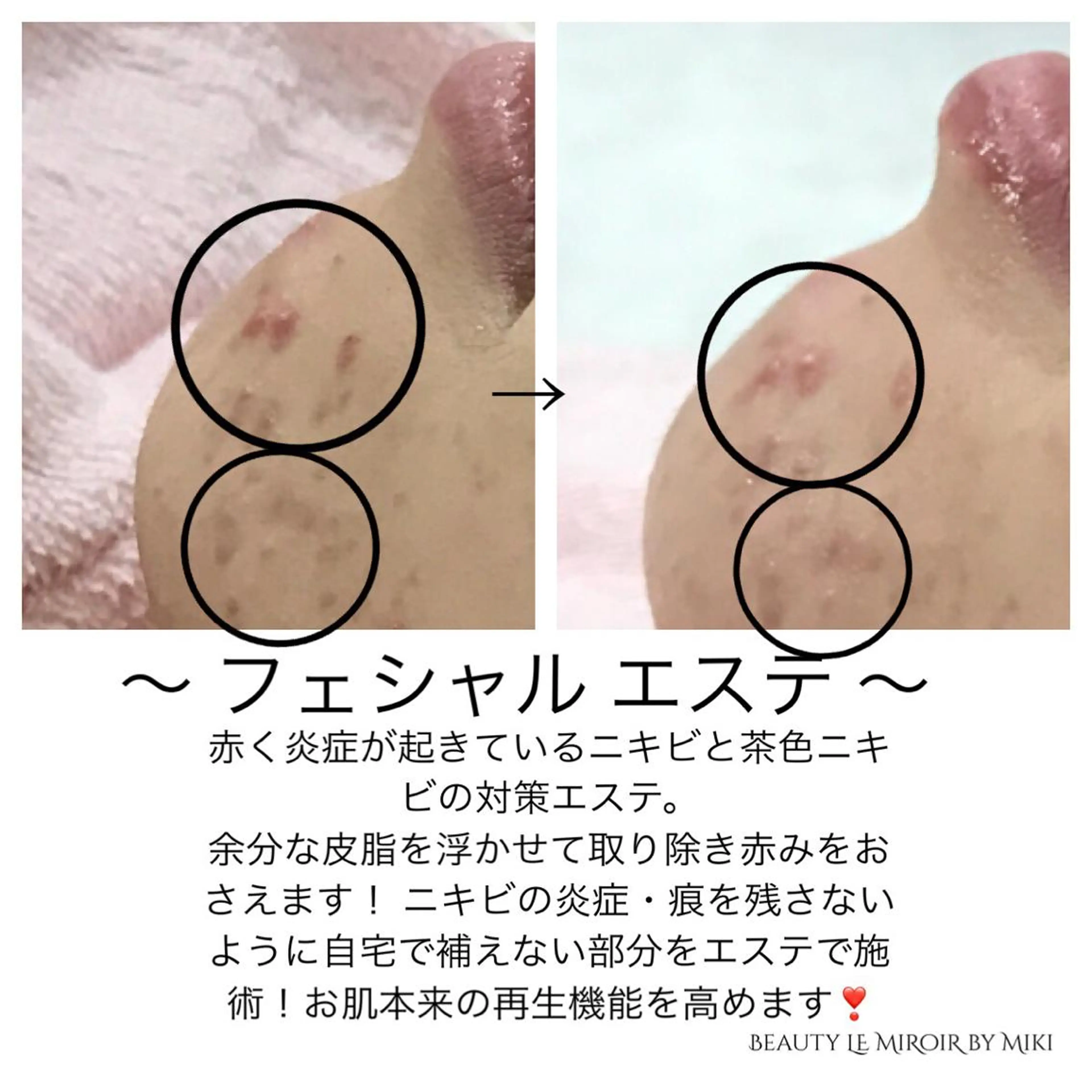 ビューティー ミロワールのエステ・リラクイメージ