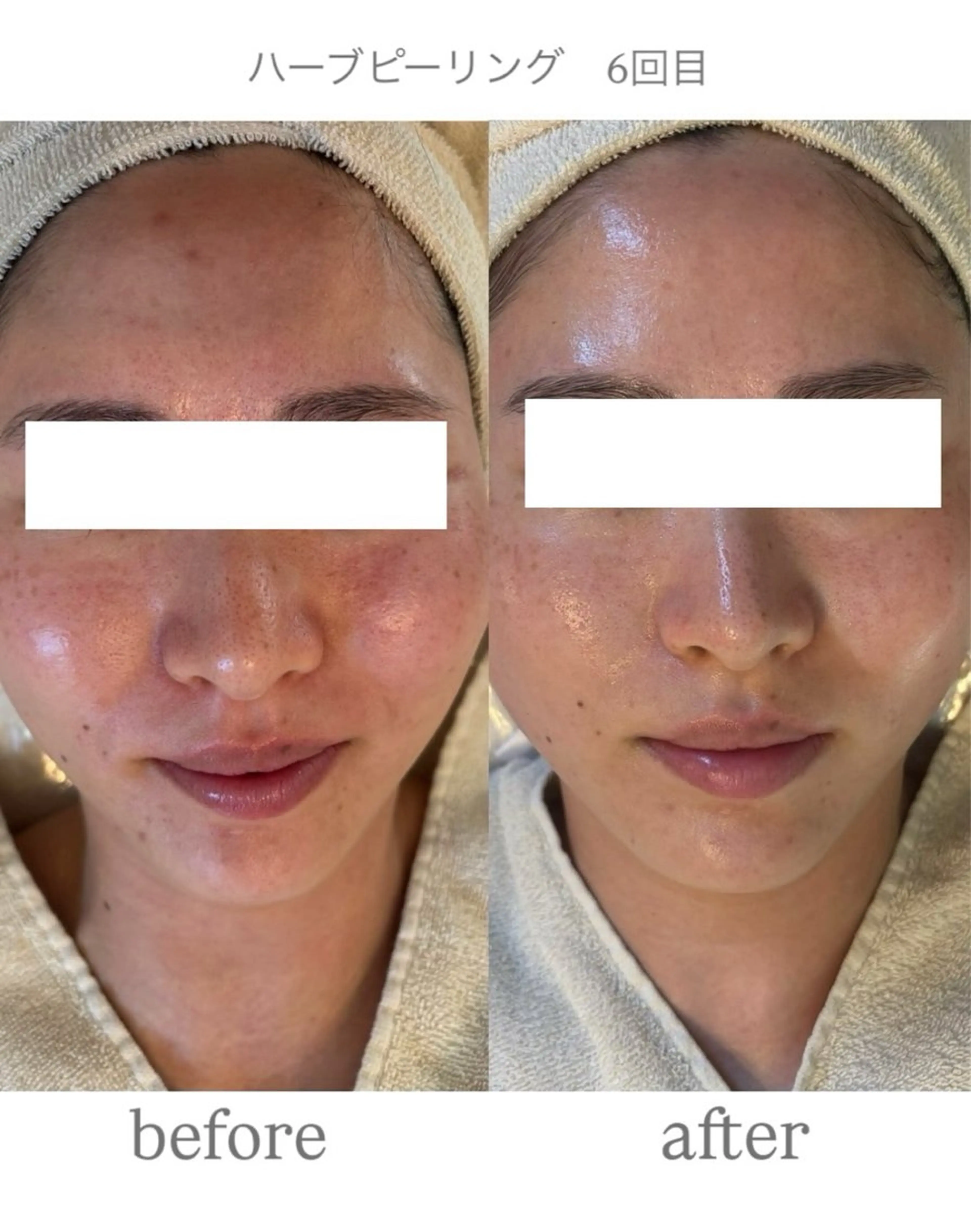 エステ anthes /MIHOのエステ・リラクイメージ