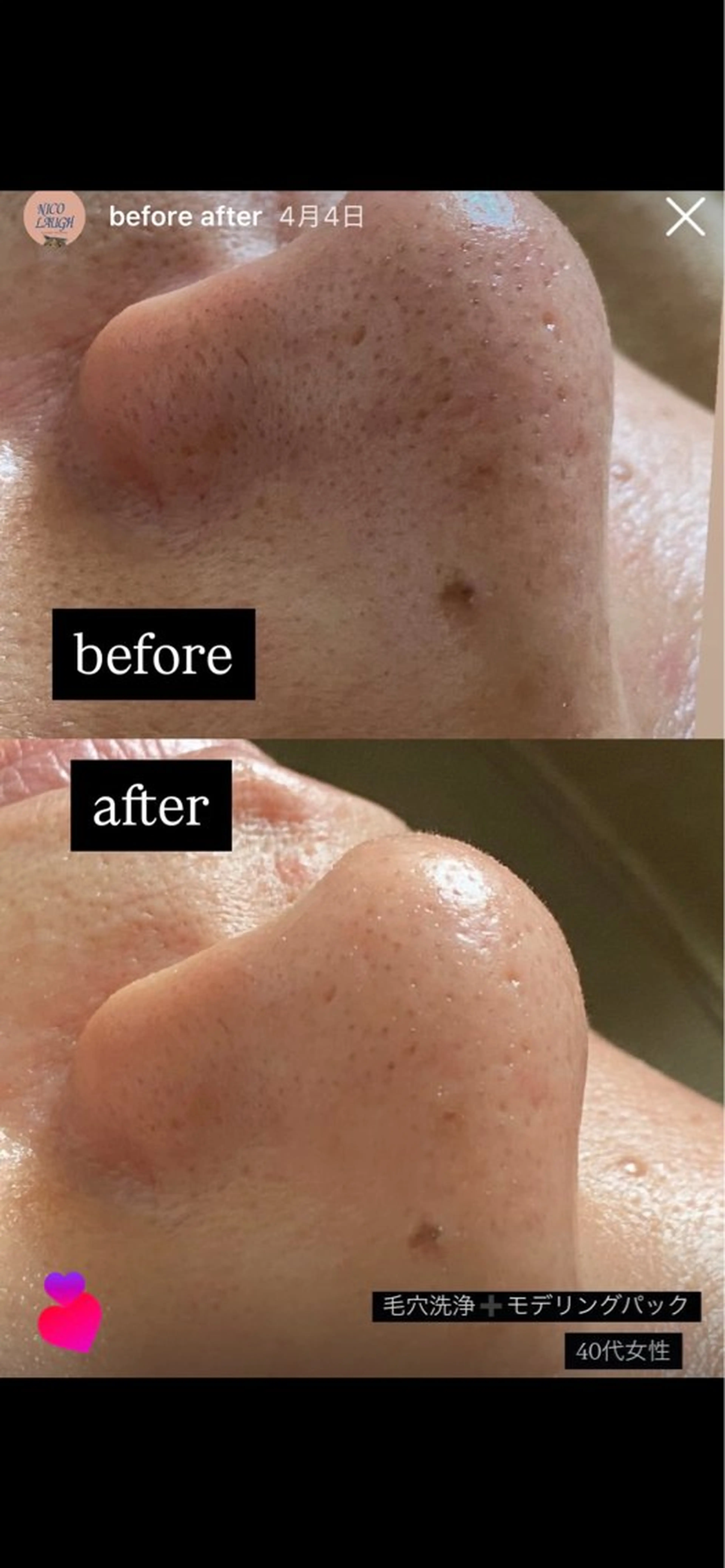 エステ リラク 【肌質改善・腸揉み】 Nico laughのエステ・リラクイメージ