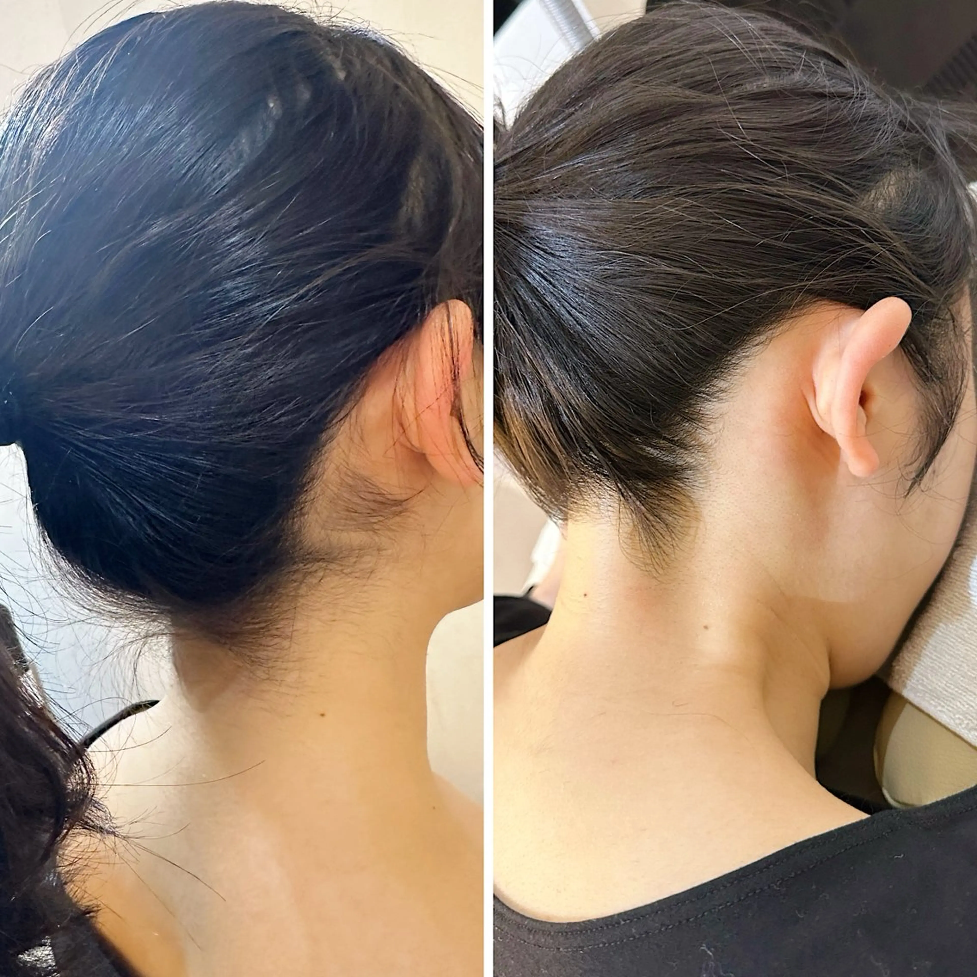 うなじ脱毛/美肌脱毛 LABELのエステ・リラクイメージ