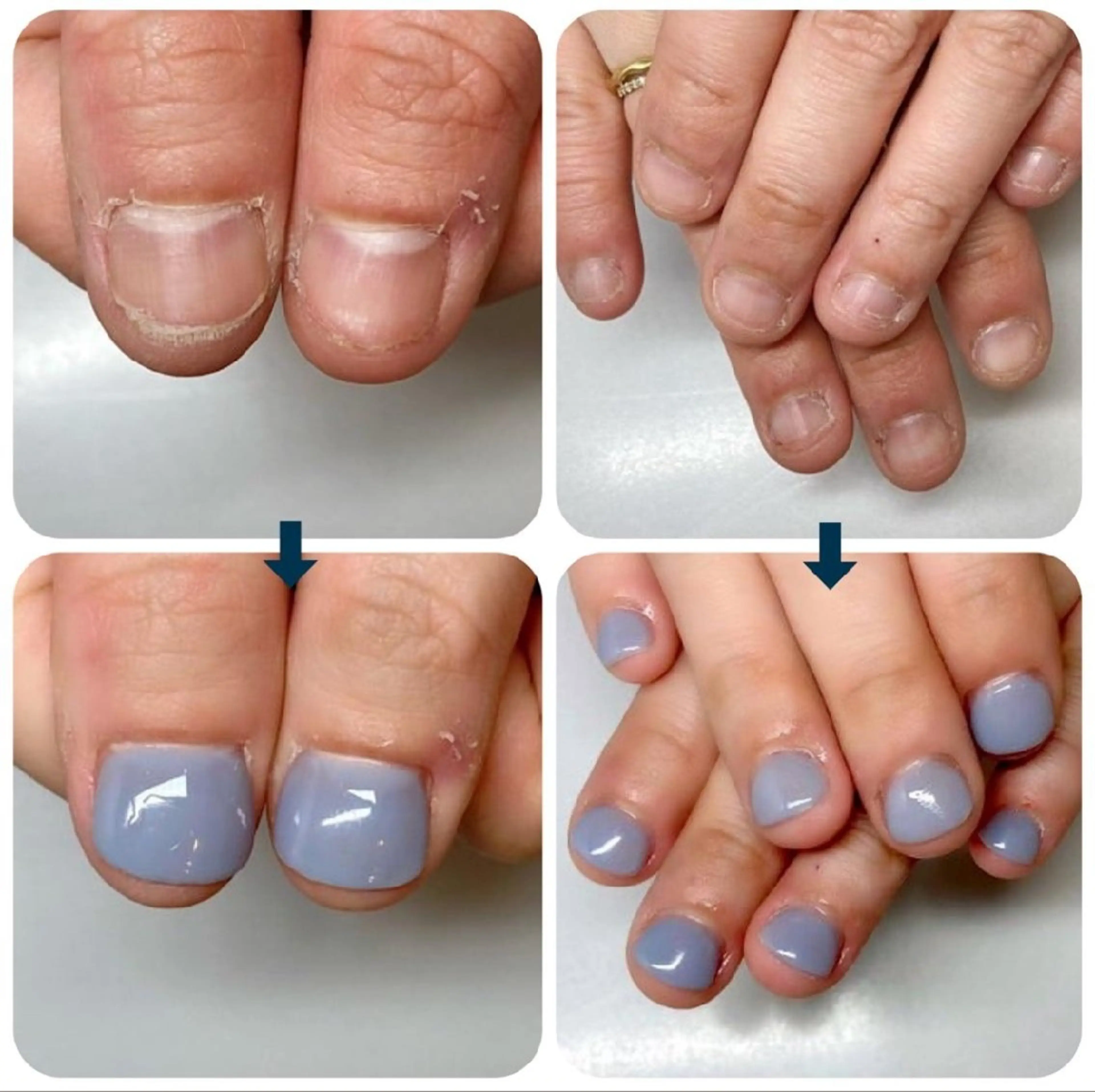 ネイル ネイルサロンアリューム所属・ネイルサロン アリュームのネイルデザイン