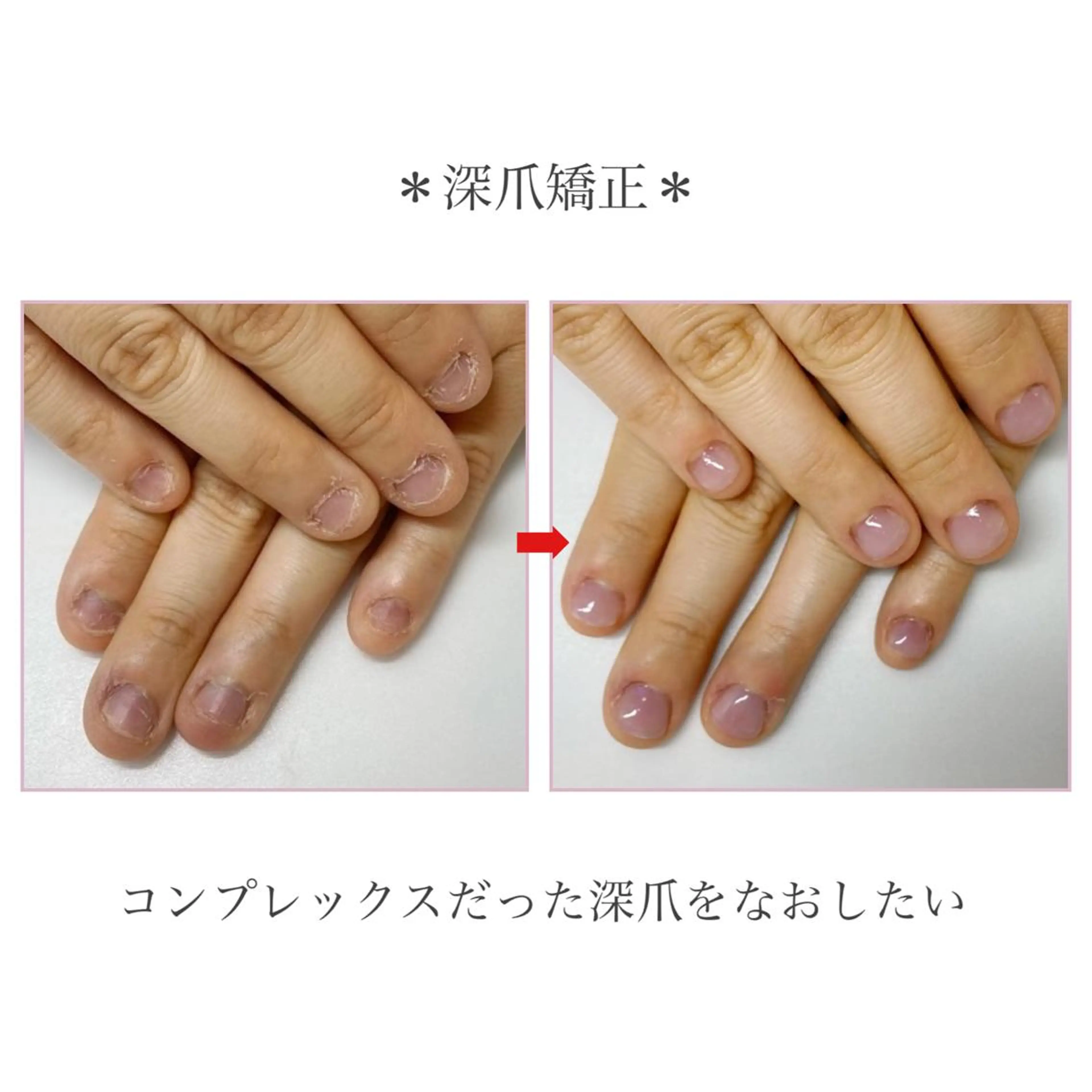 ネイル ネイルサロン アリュームのネイルデザイン