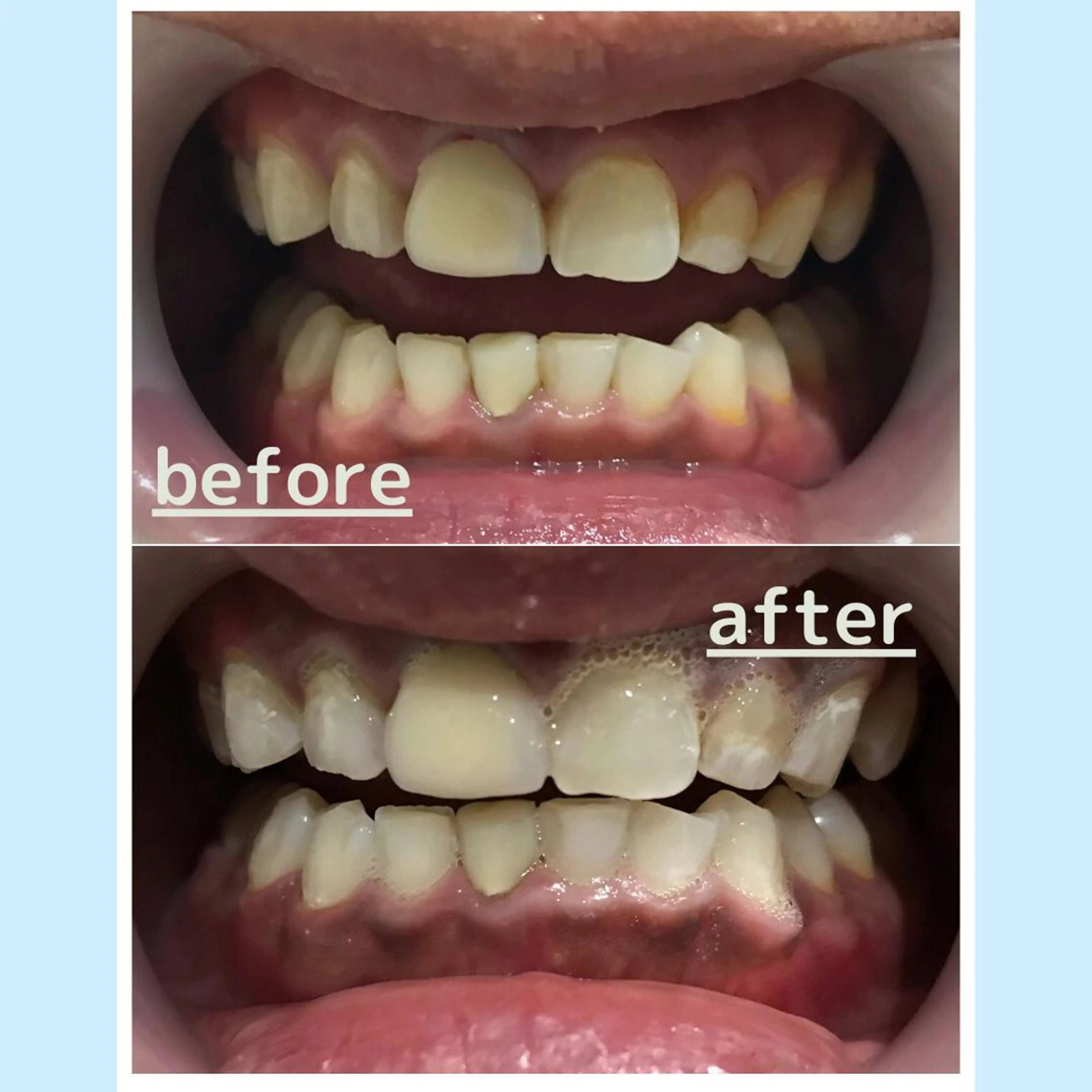 メンズ お手軽ホワイトニングsalon mina所属・武元 奈津美のその他イメージ