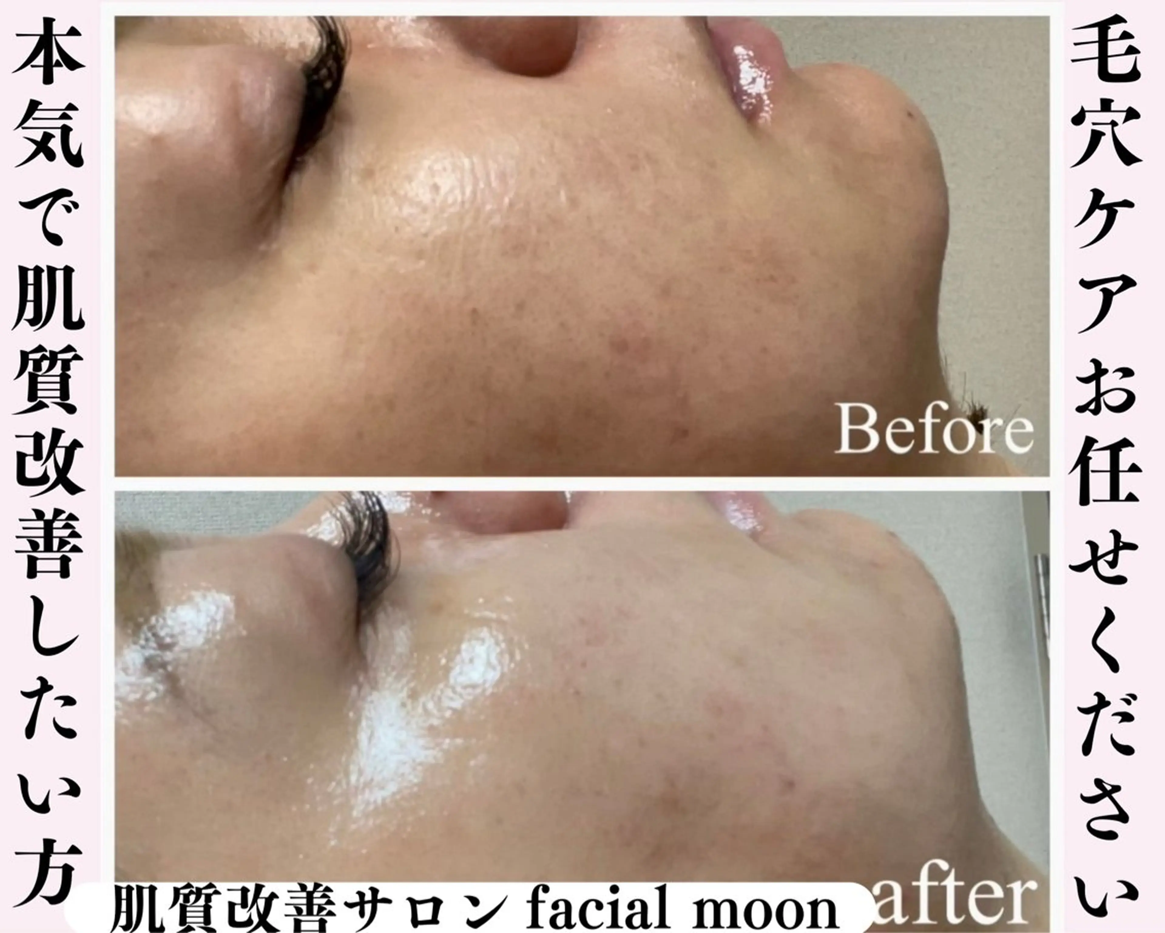 肌質改善サロン facialmoonのエステ・リラクイメージ