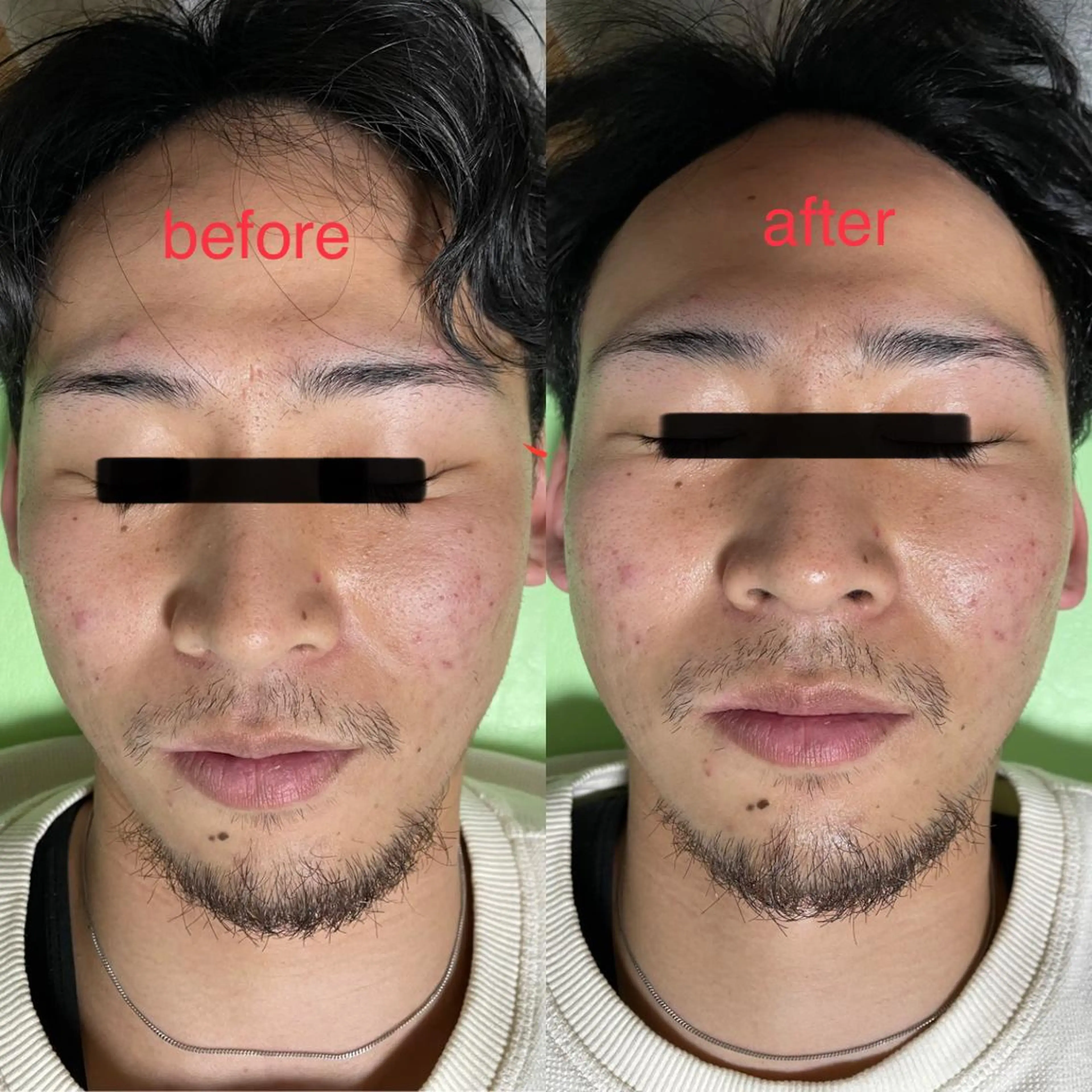 蓮花鍼灸 整骨院のエステ・リラクイメージ