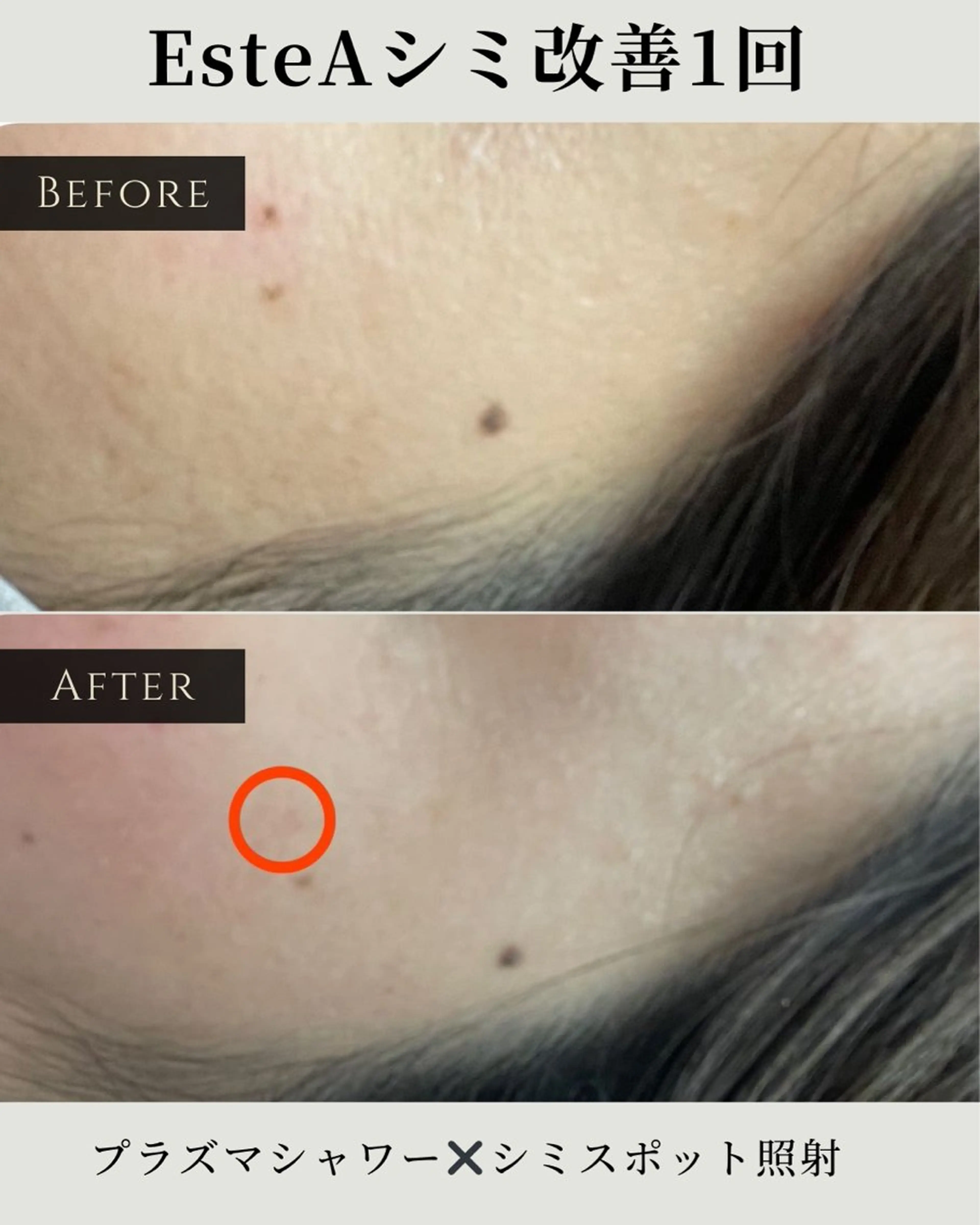 稲垣 優のエステ・リラクイメージ