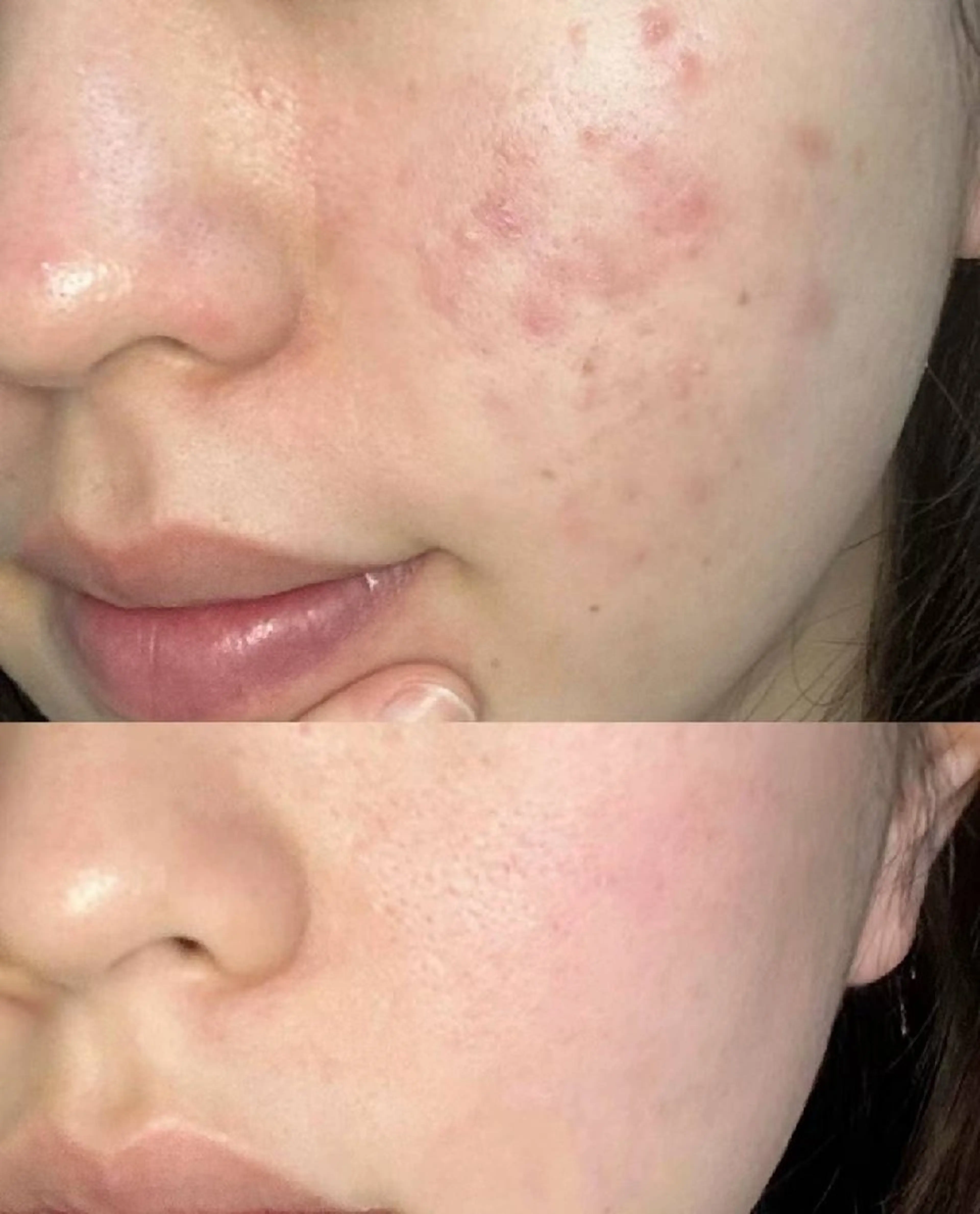 ネイル ブライダルネイル ホワイト aliaハイフ&水光ジェットサロン所属・aliaハーブ水光店 エステティシャン募集のエステ・リラクイメージ