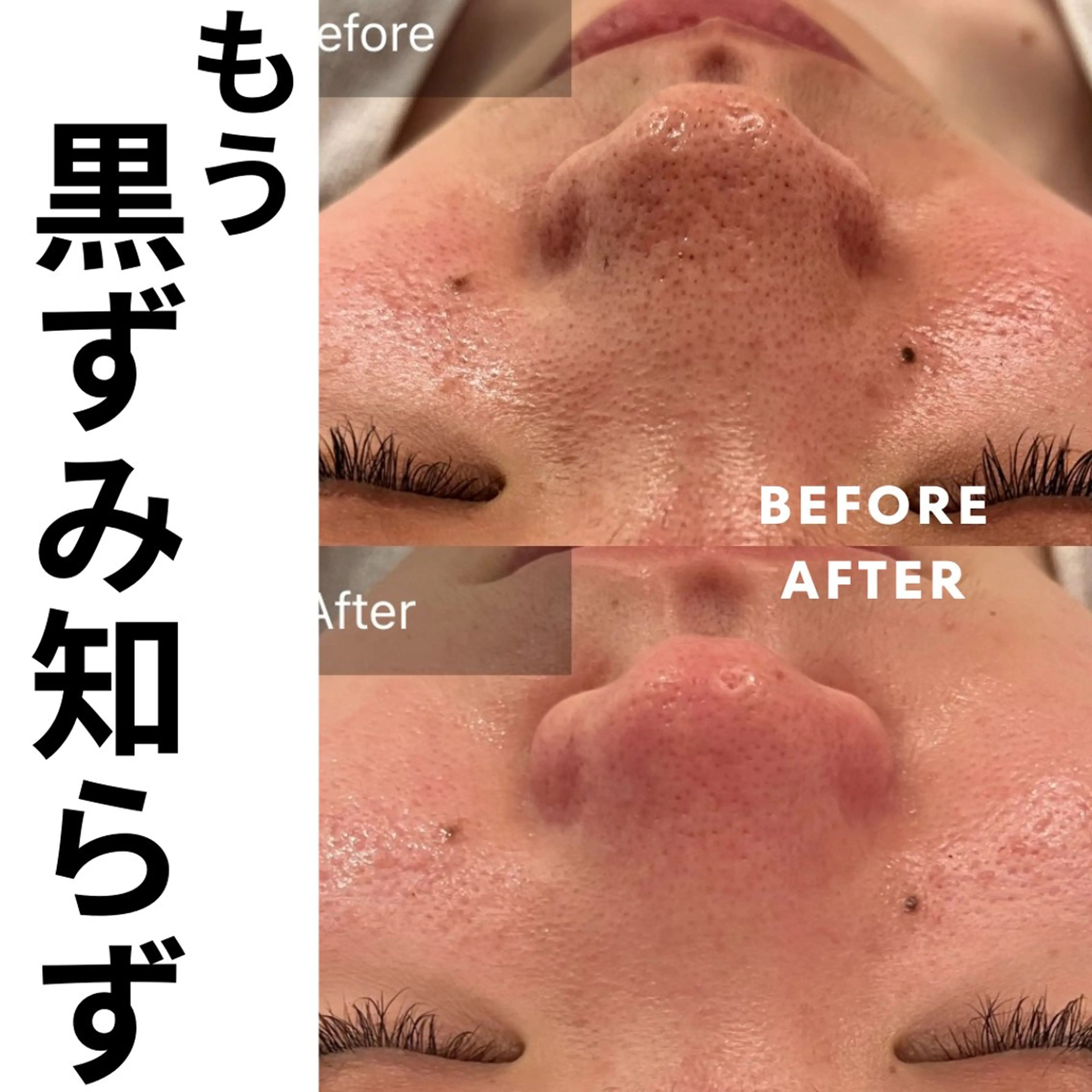 エステ リラク Lune’as Spa 南青山🫧のエステ・リラクイメージ