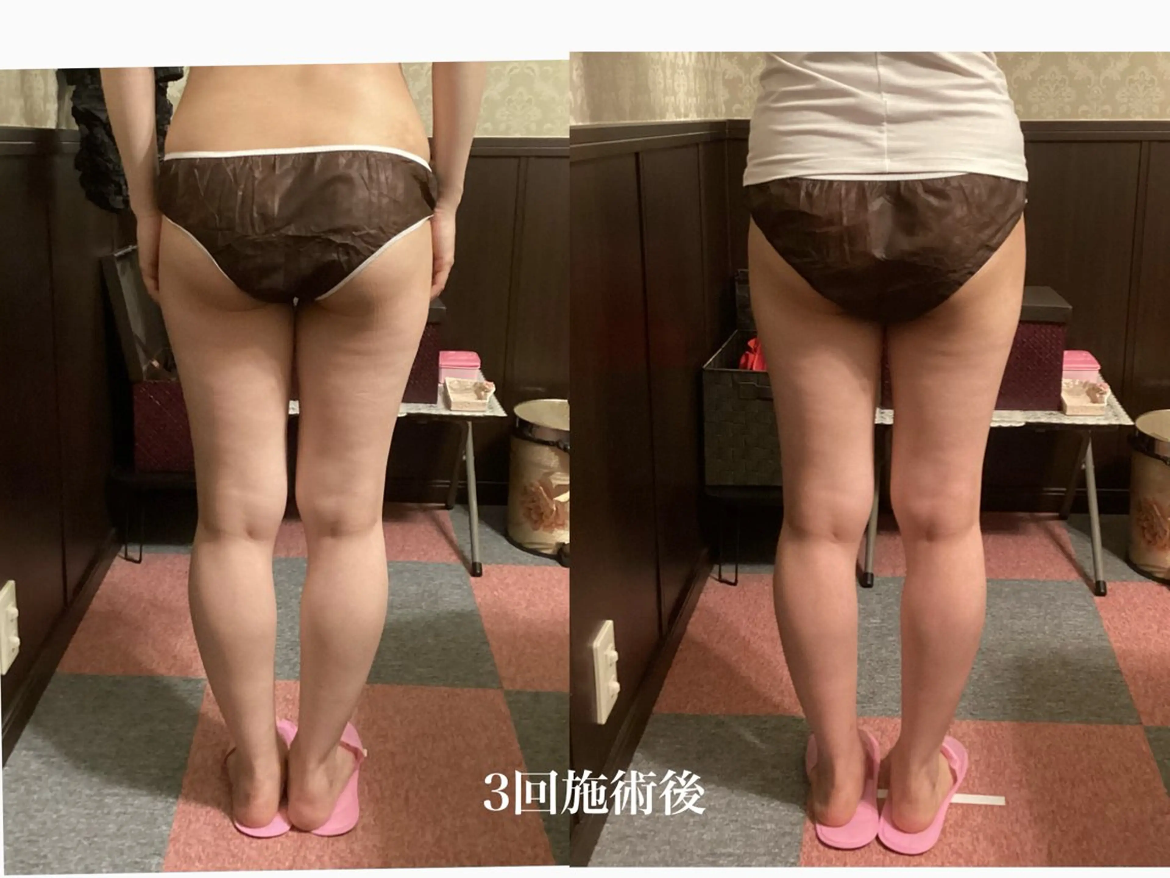 エステ エステティックサロン 凜のエステ・リラクイメージ