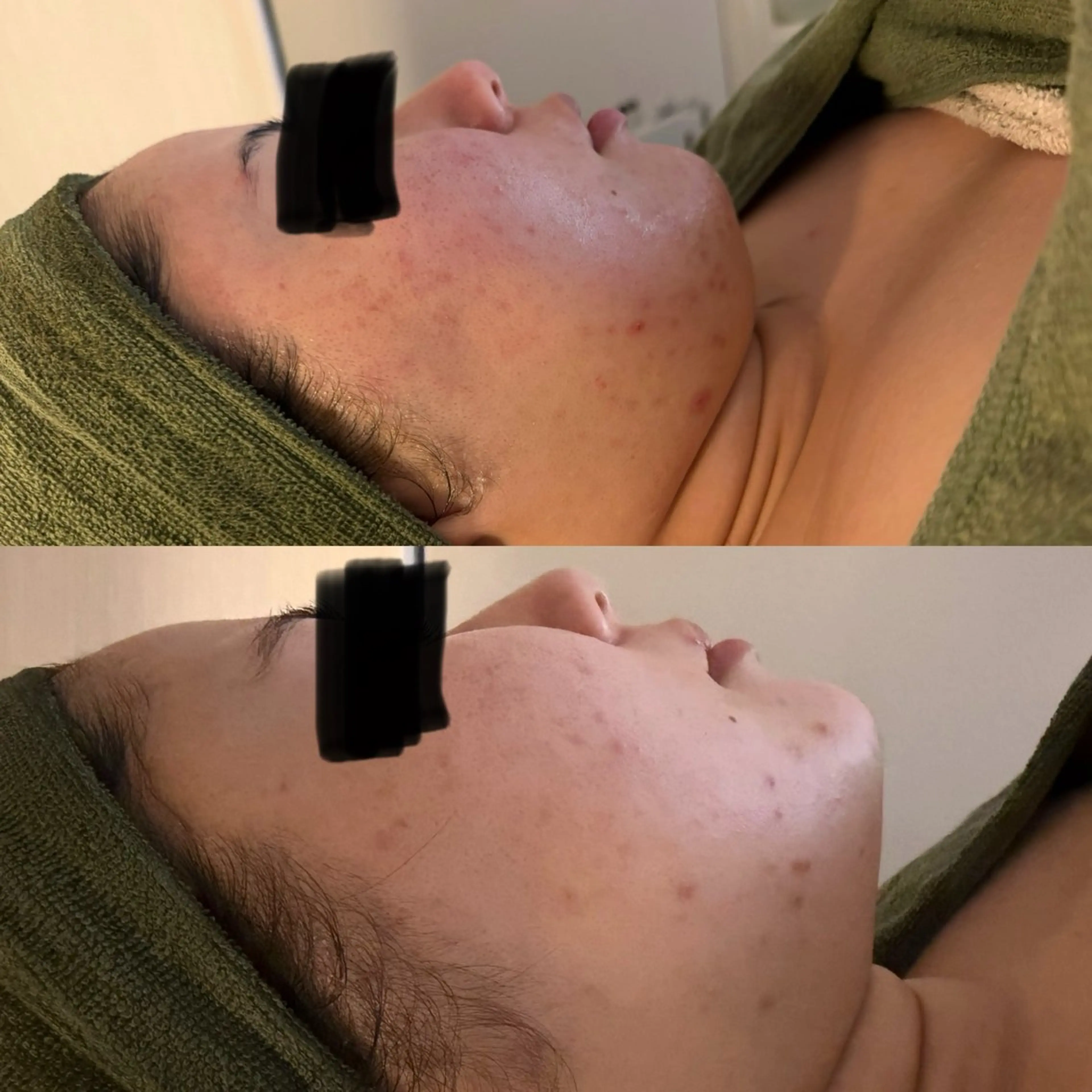 エステ よもぎ蒸しサロンc.iエステティック所属・睡眠の質／体質改善 c.iエステティックのエステ・リラクイメージ