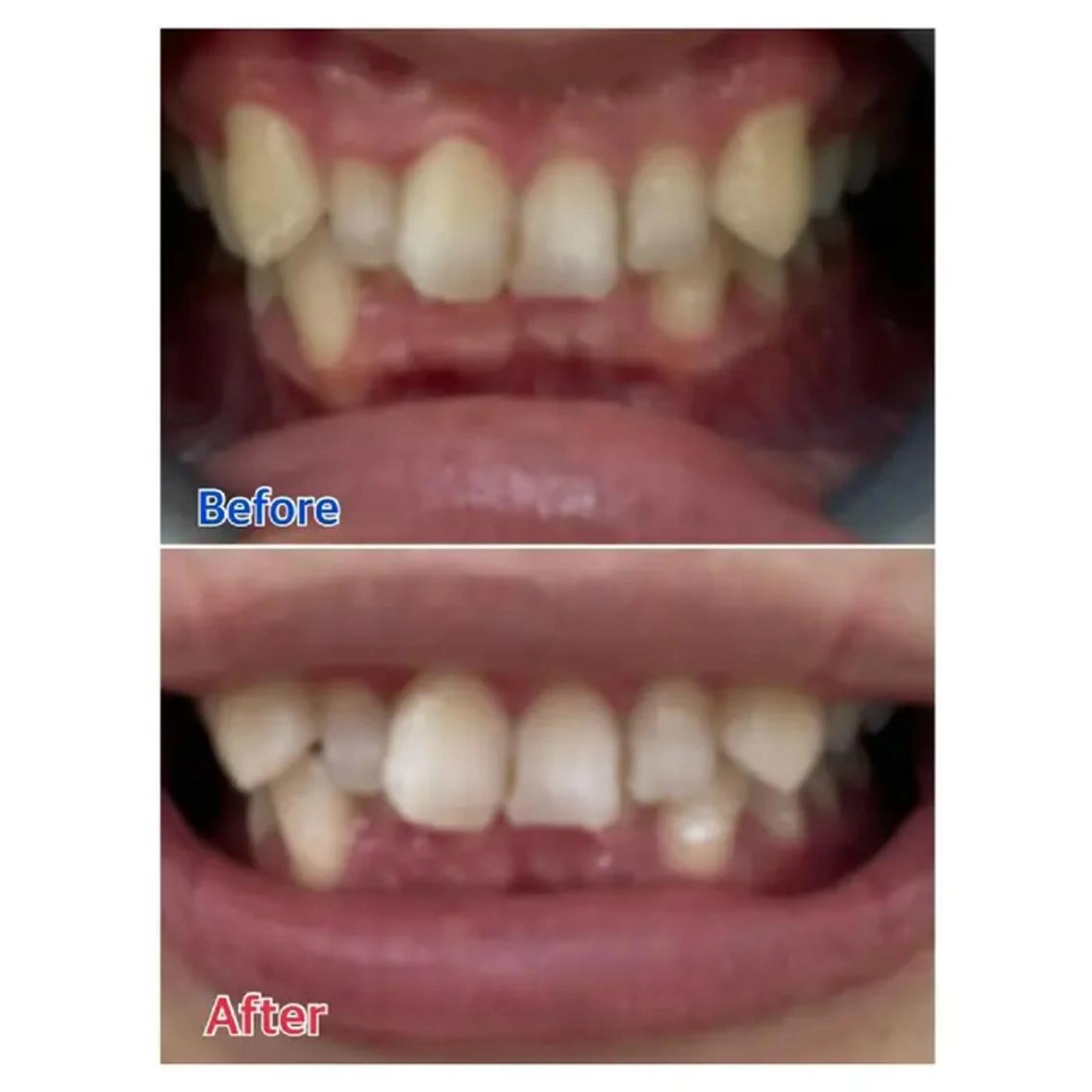 M渋谷 ホワイトニングのエステ・リラクイメージ