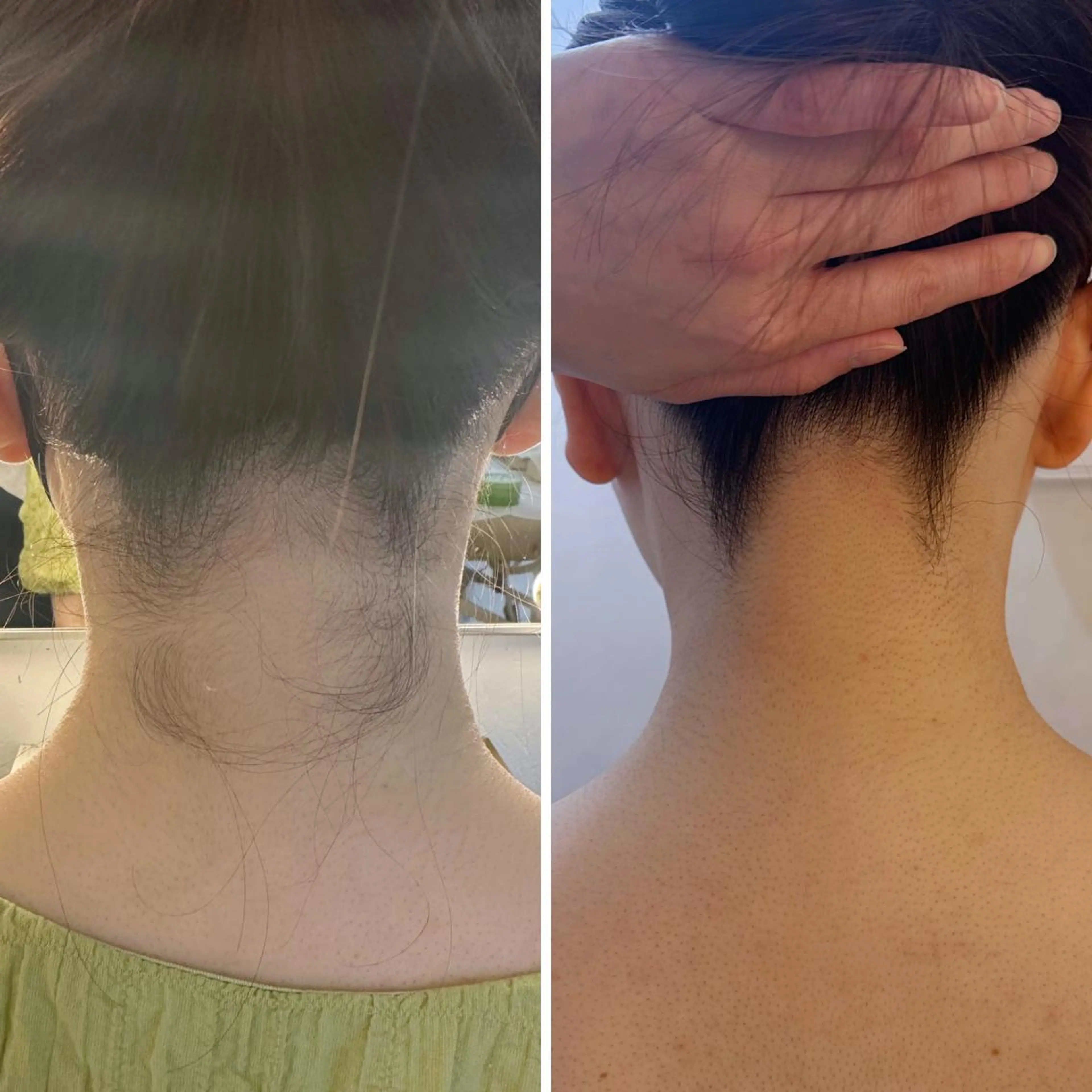 うなじ脱毛/美肌脱毛 LABELのエステ・リラクイメージ