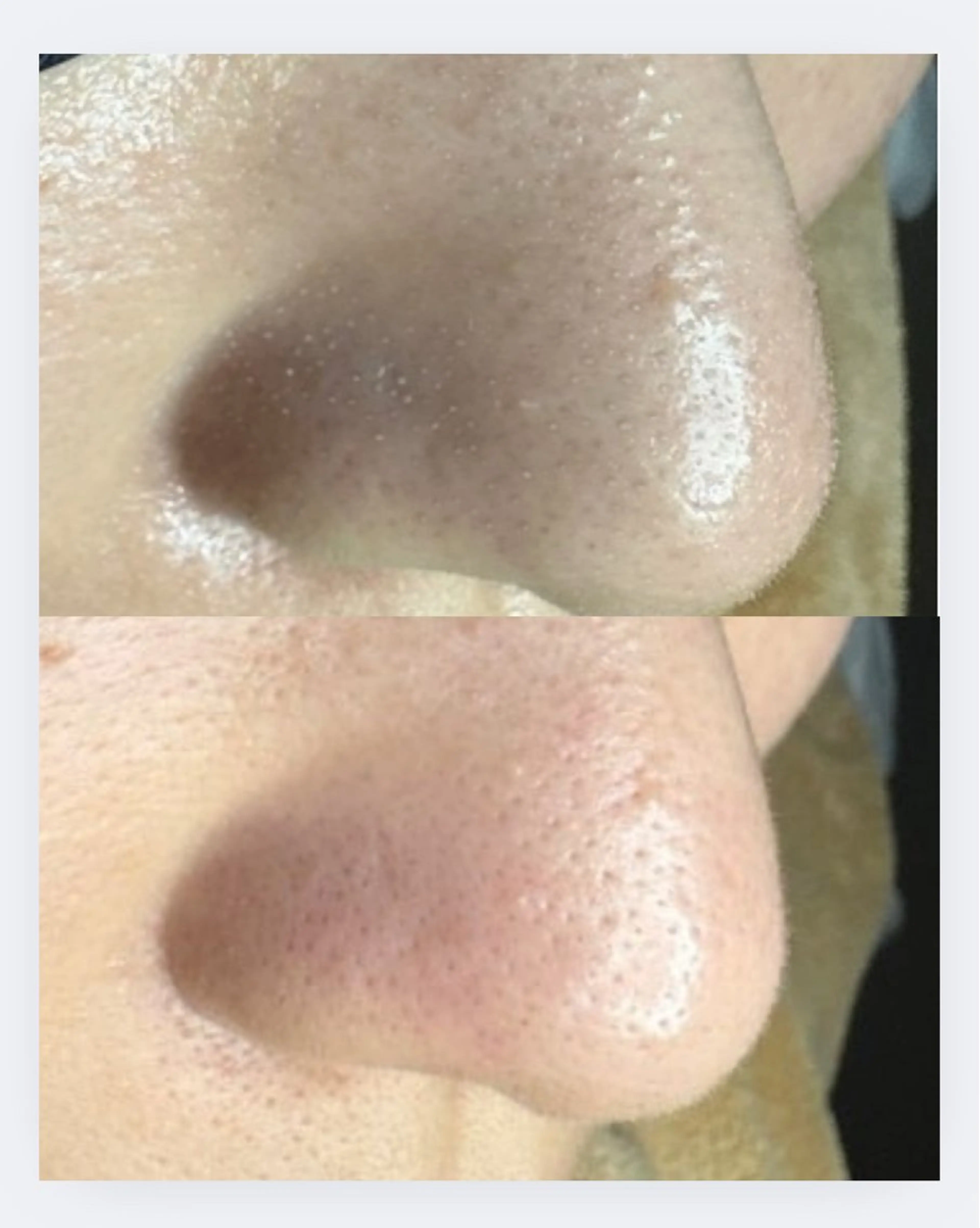 beauty salonN.11のエステ・リラクイメージ