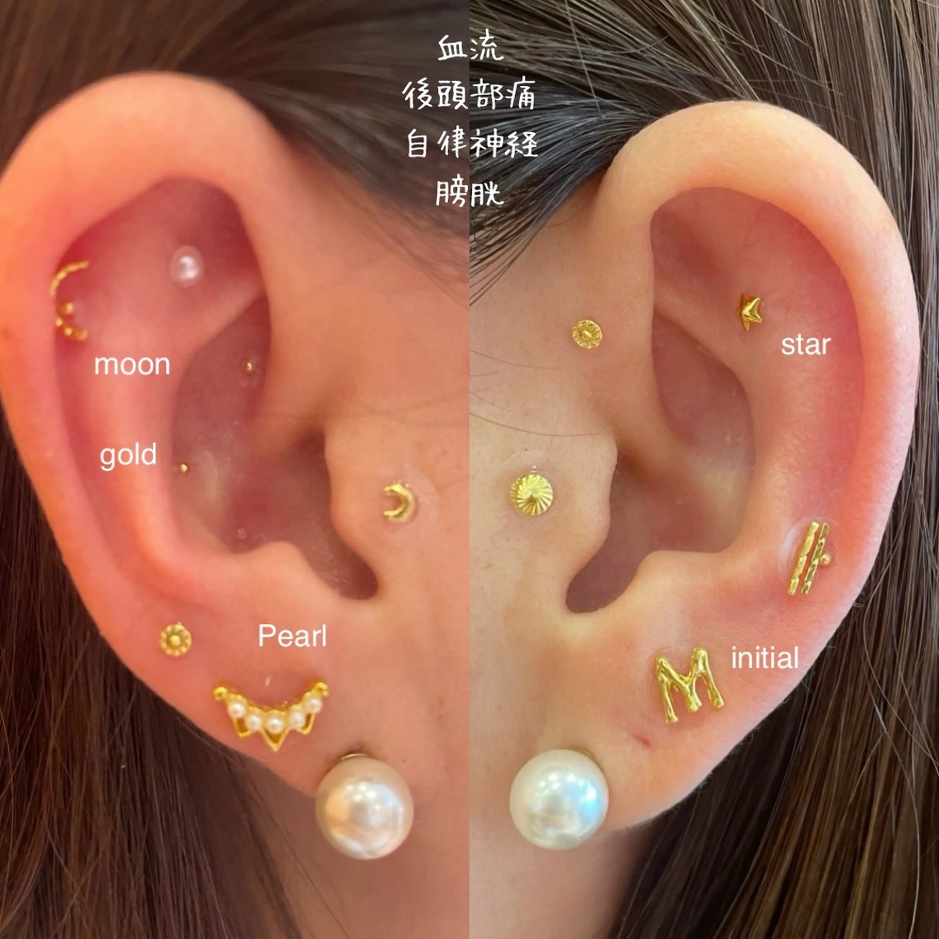 耳つぼｼﾞｭｴﾘｰ両耳10粒の写真