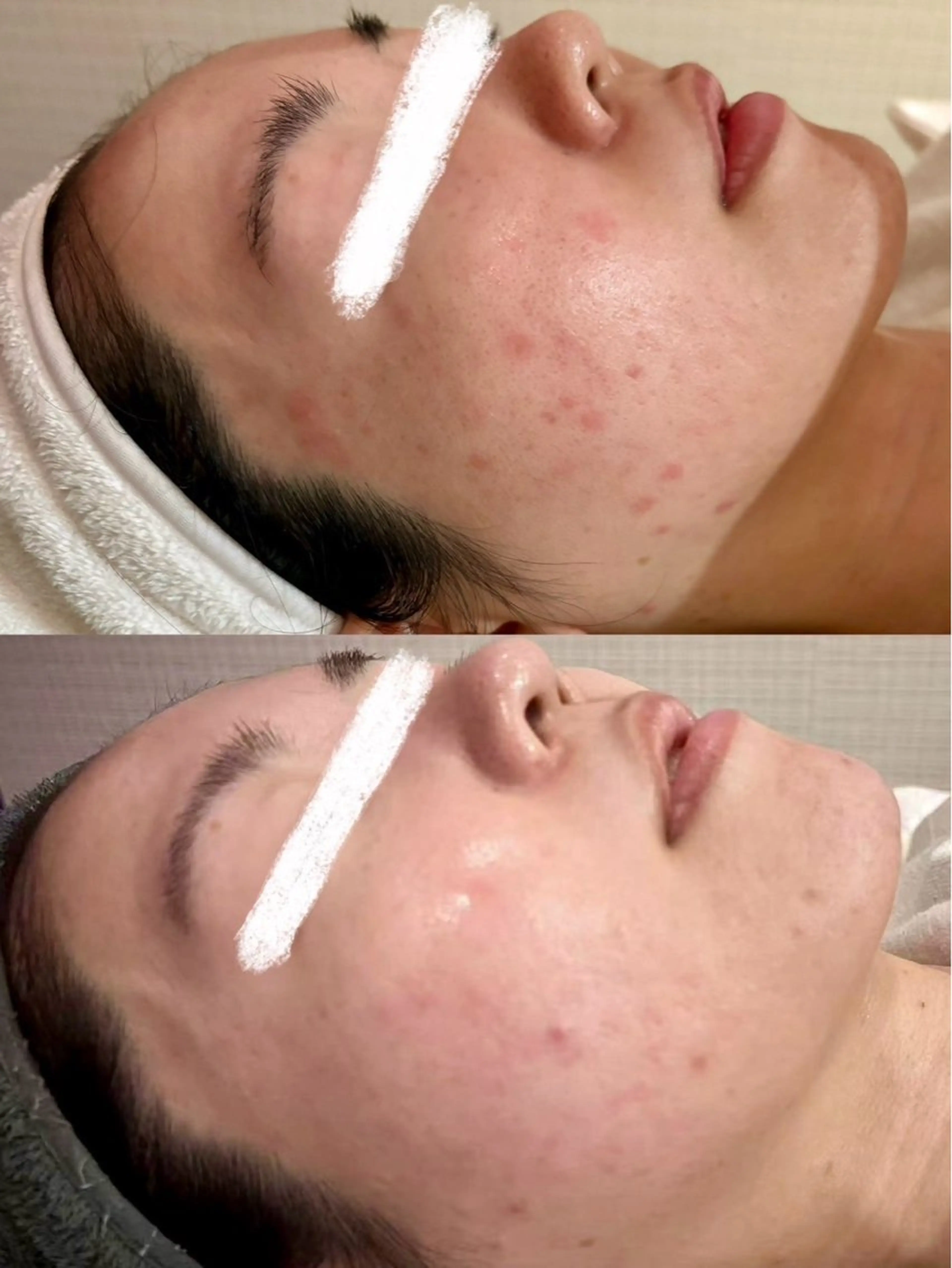 ハーブピーリング専門 グランディール　武内のエステ・リラクイメージ