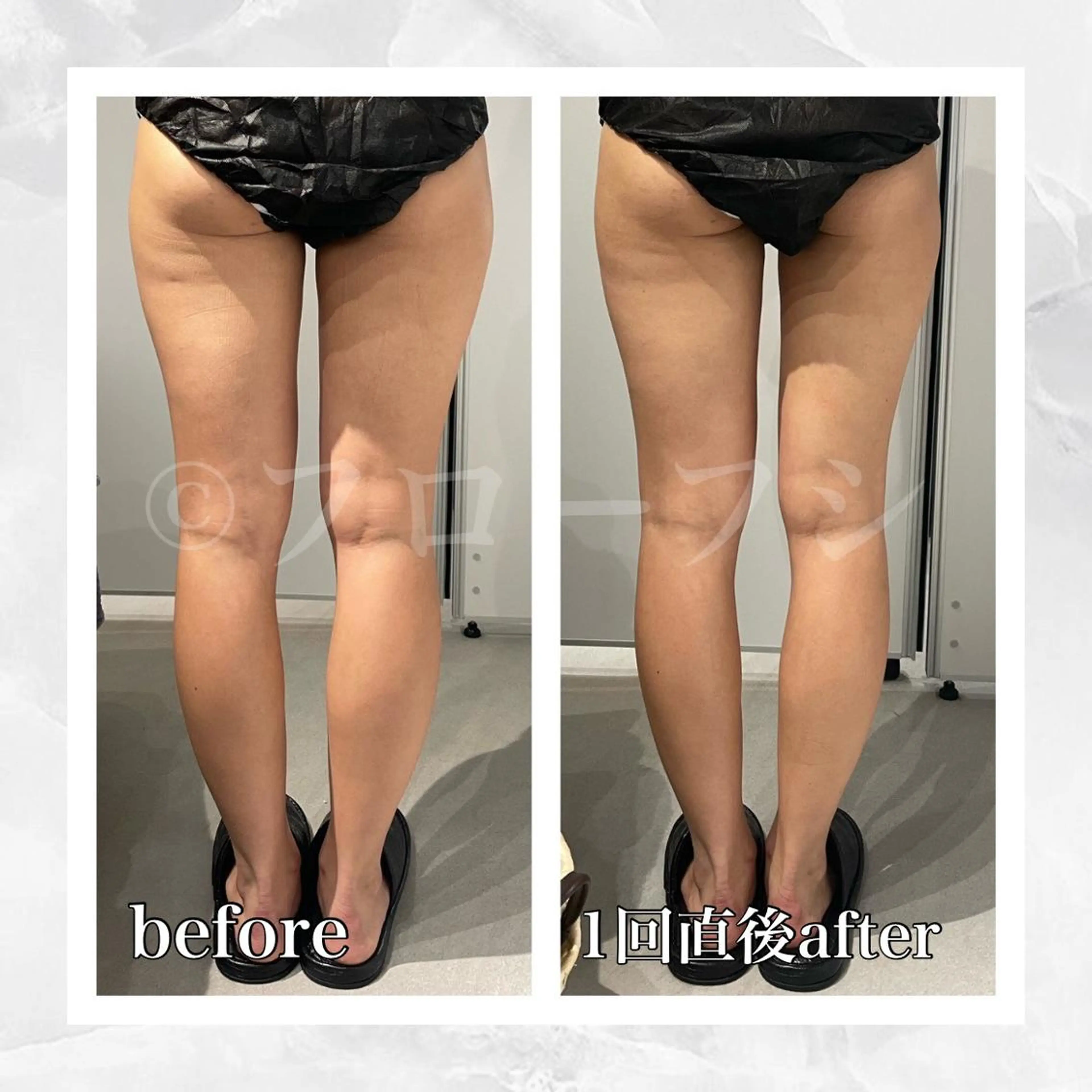 エステ リラク 部分痩せ♥️小顔専門 MIKUのエステ・リラクイメージ